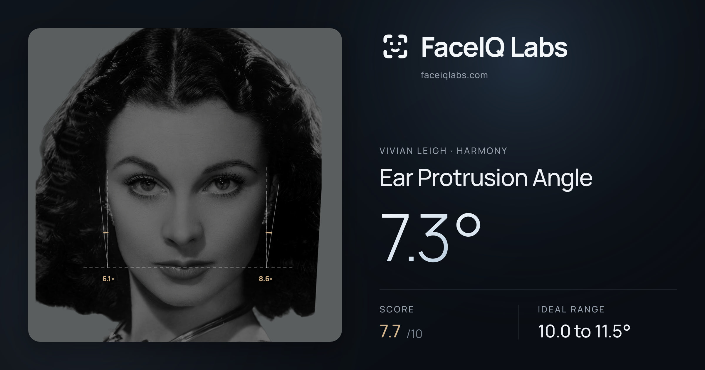Vivian Leigh Ear Protrusion Angle: 7.3°, drawn on the photo