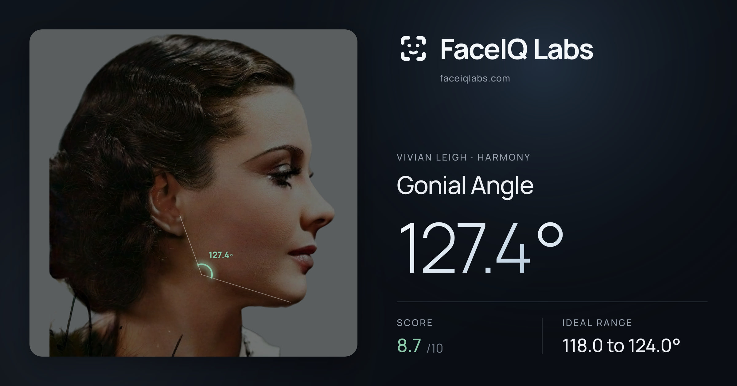 Vivian Leigh Gonial Angle: 127.4°, drawn on the photo