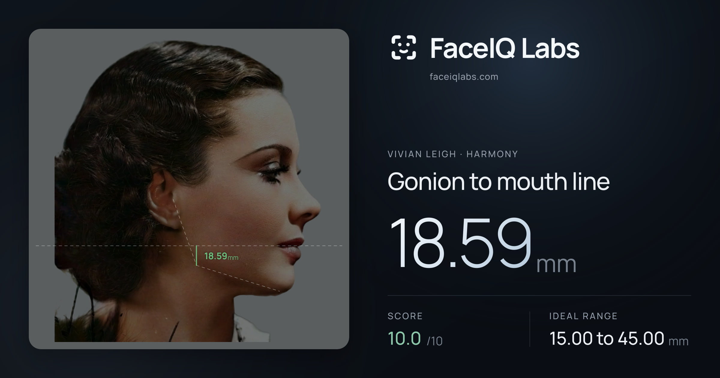 Vivian Leigh Gonion to mouth line: 18.59mm, drawn on the photo