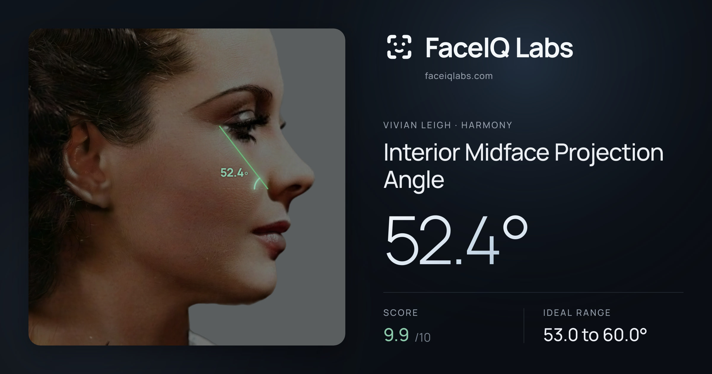 Vivian Leigh Interior Midface Projection Angle: 52.4°, drawn on the photo