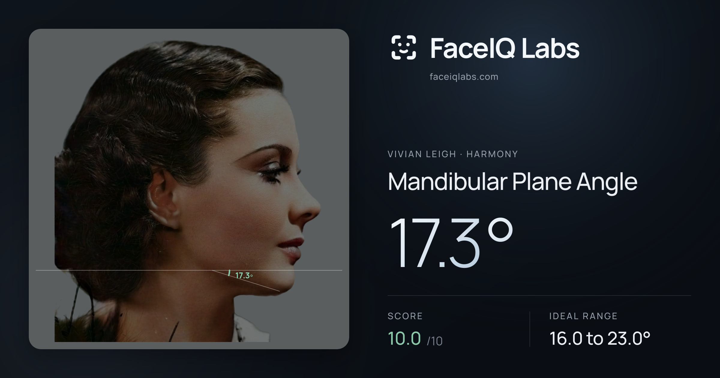 Vivian Leigh Mandibular Plane Angle: 17.3°, drawn on the photo
