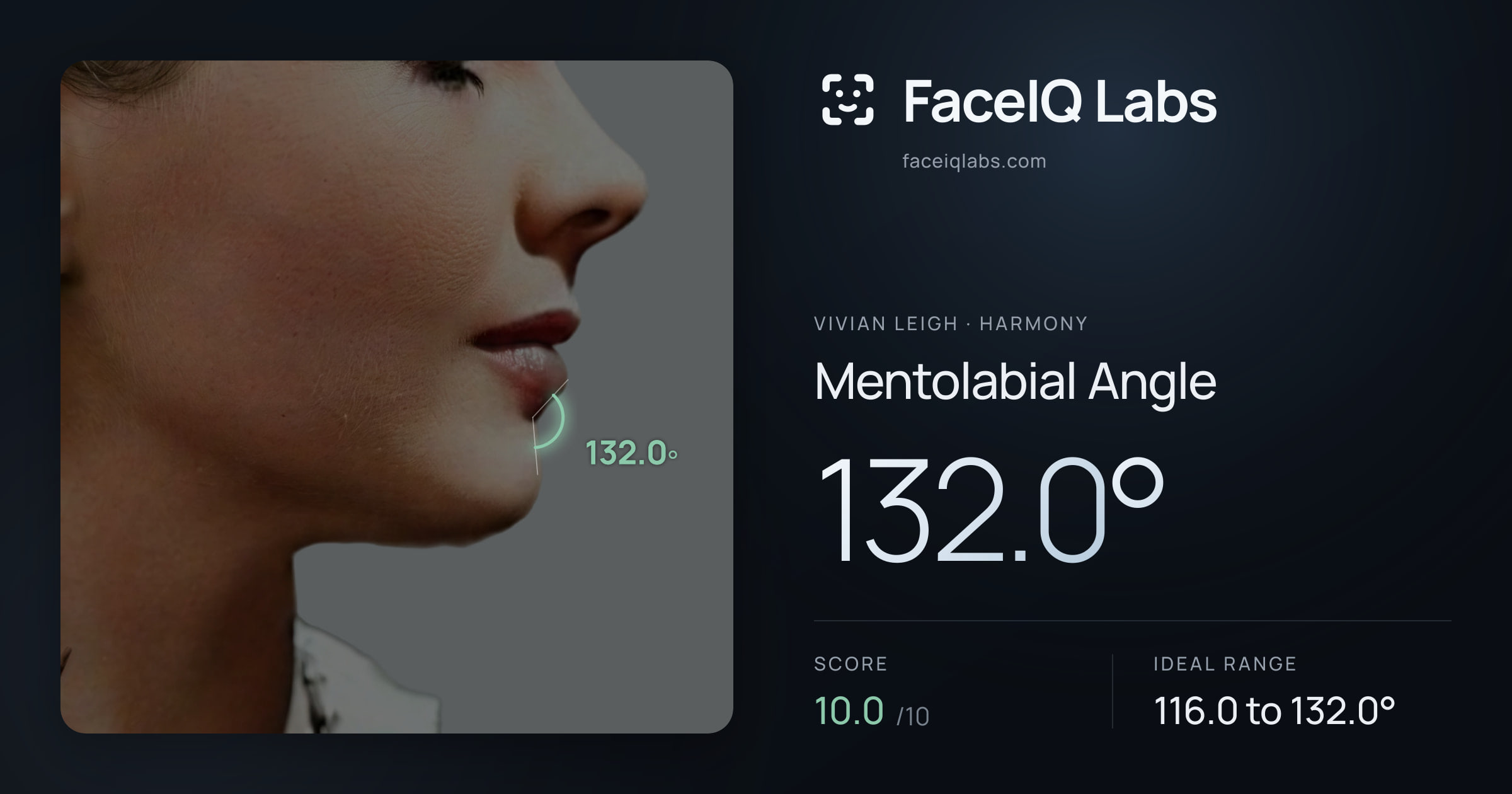 Vivian Leigh Mentolabial Angle: 132.0°, drawn on the photo