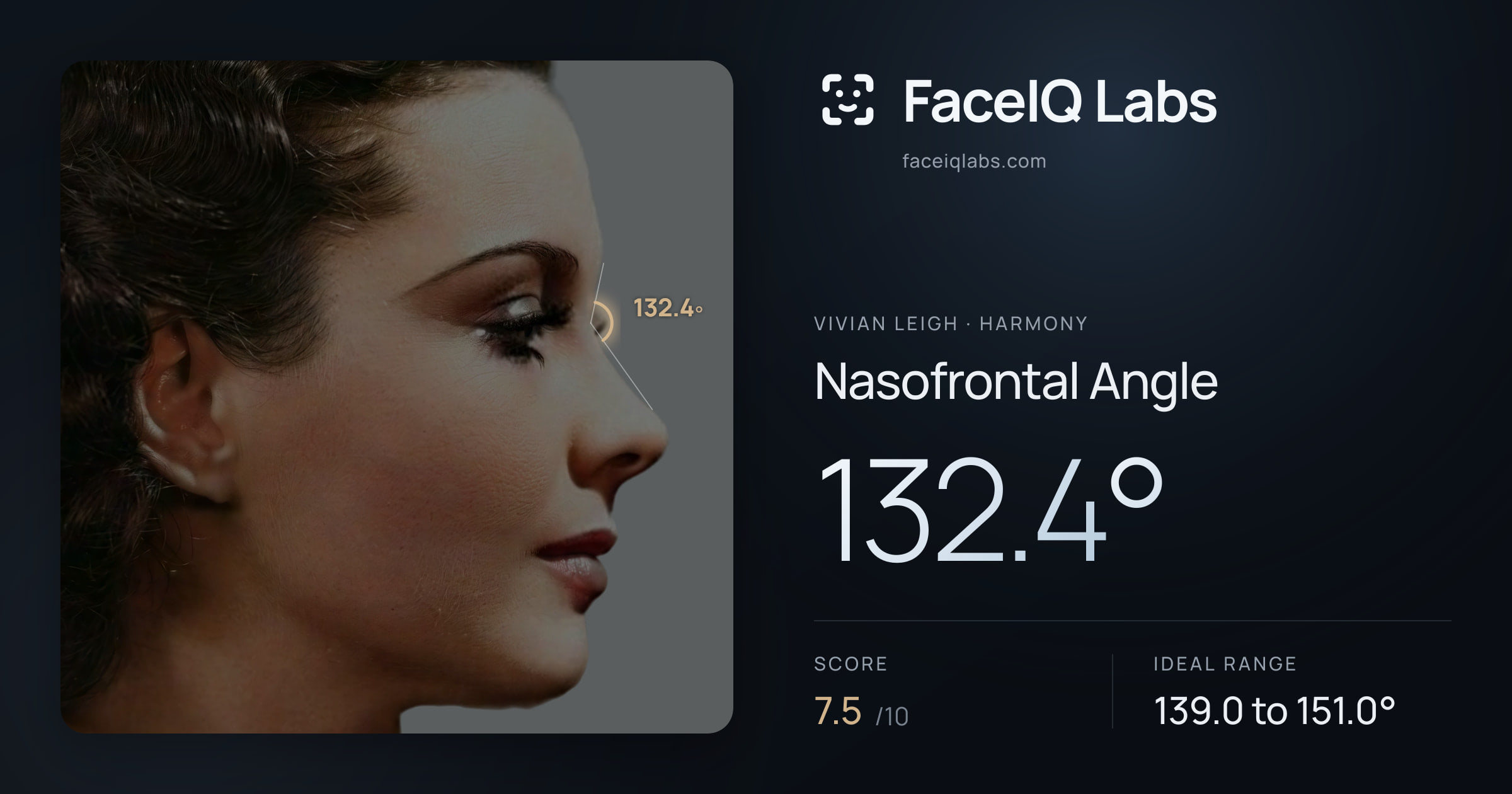 Vivian Leigh Nasofrontal Angle: 132.4°, drawn on the photo
