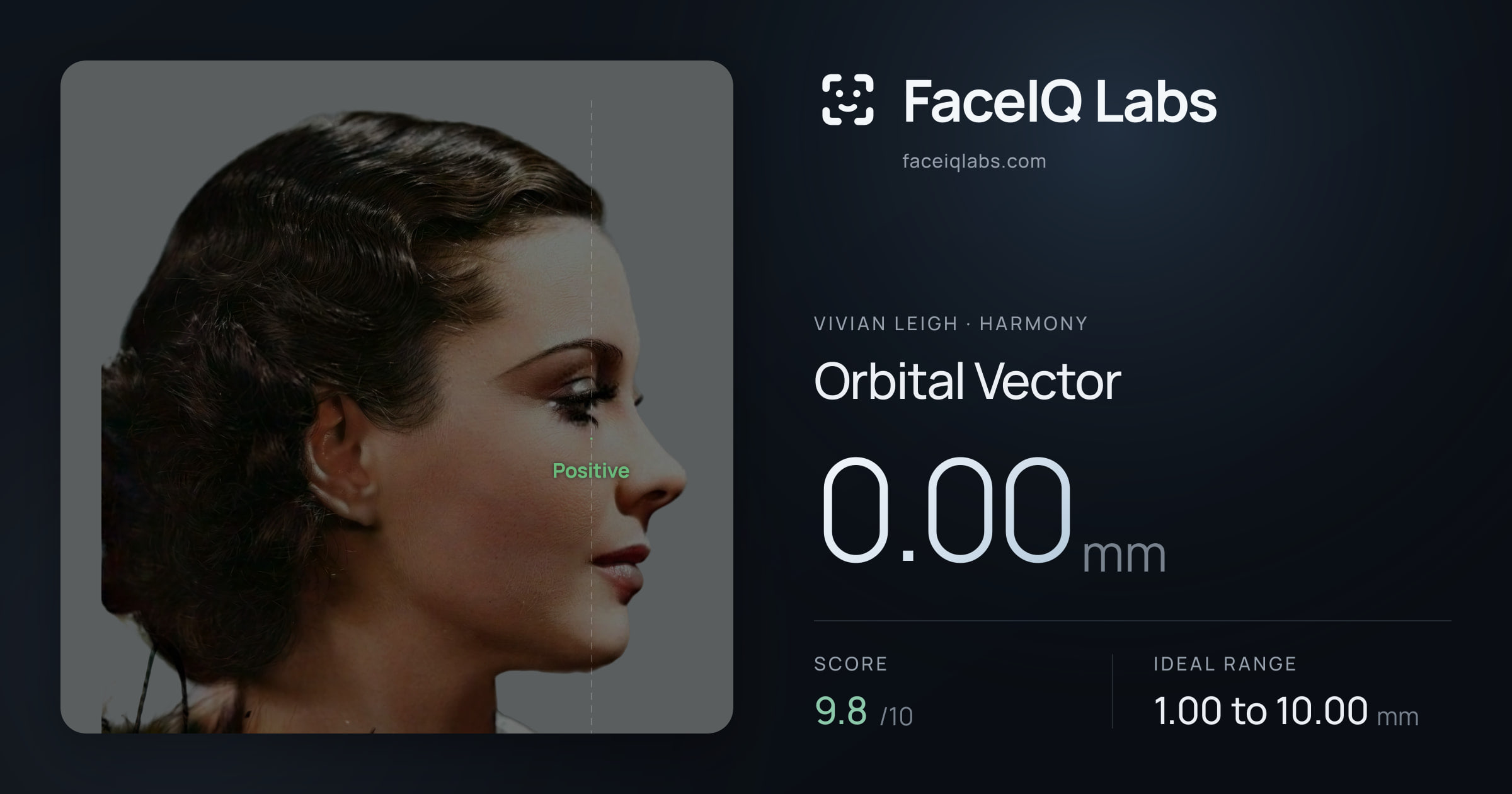 Vivian Leigh Orbital Vector: 0.00mm, drawn on the photo
