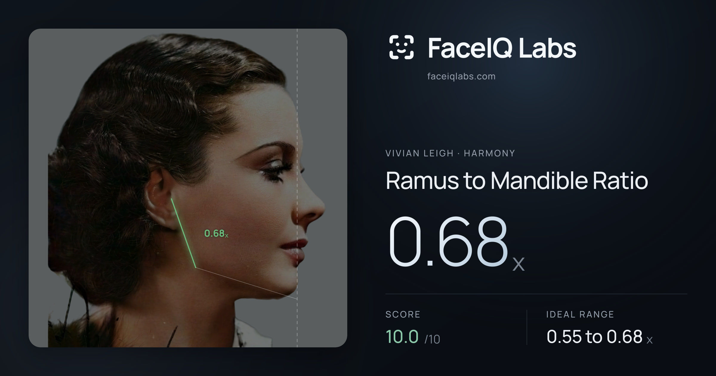 Vivian Leigh Ramus to Mandible Ratio: 0.68x, drawn on the photo