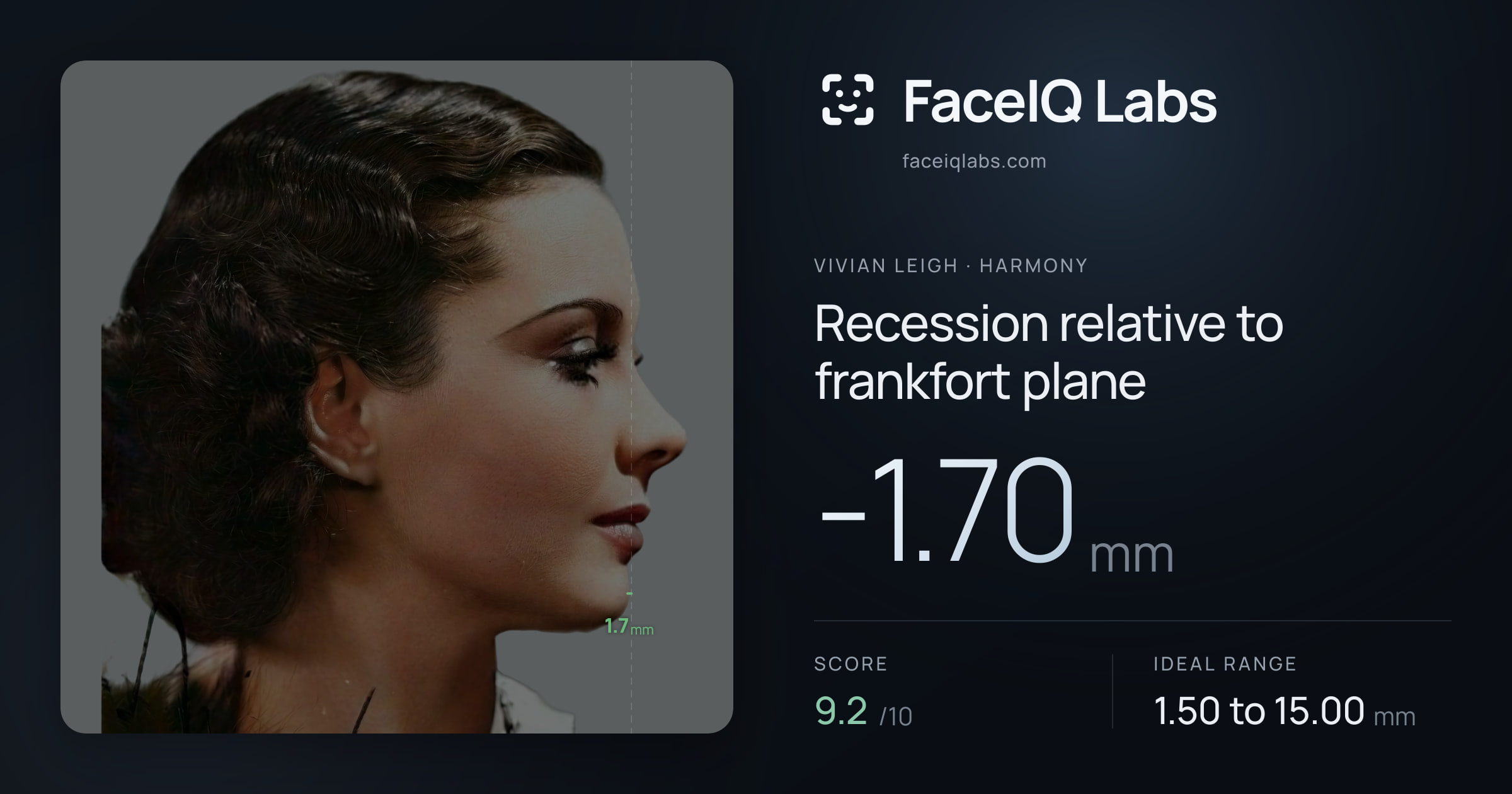 Vivian Leigh Recession relative to frankfort plane: -1.70mm, drawn on the photo