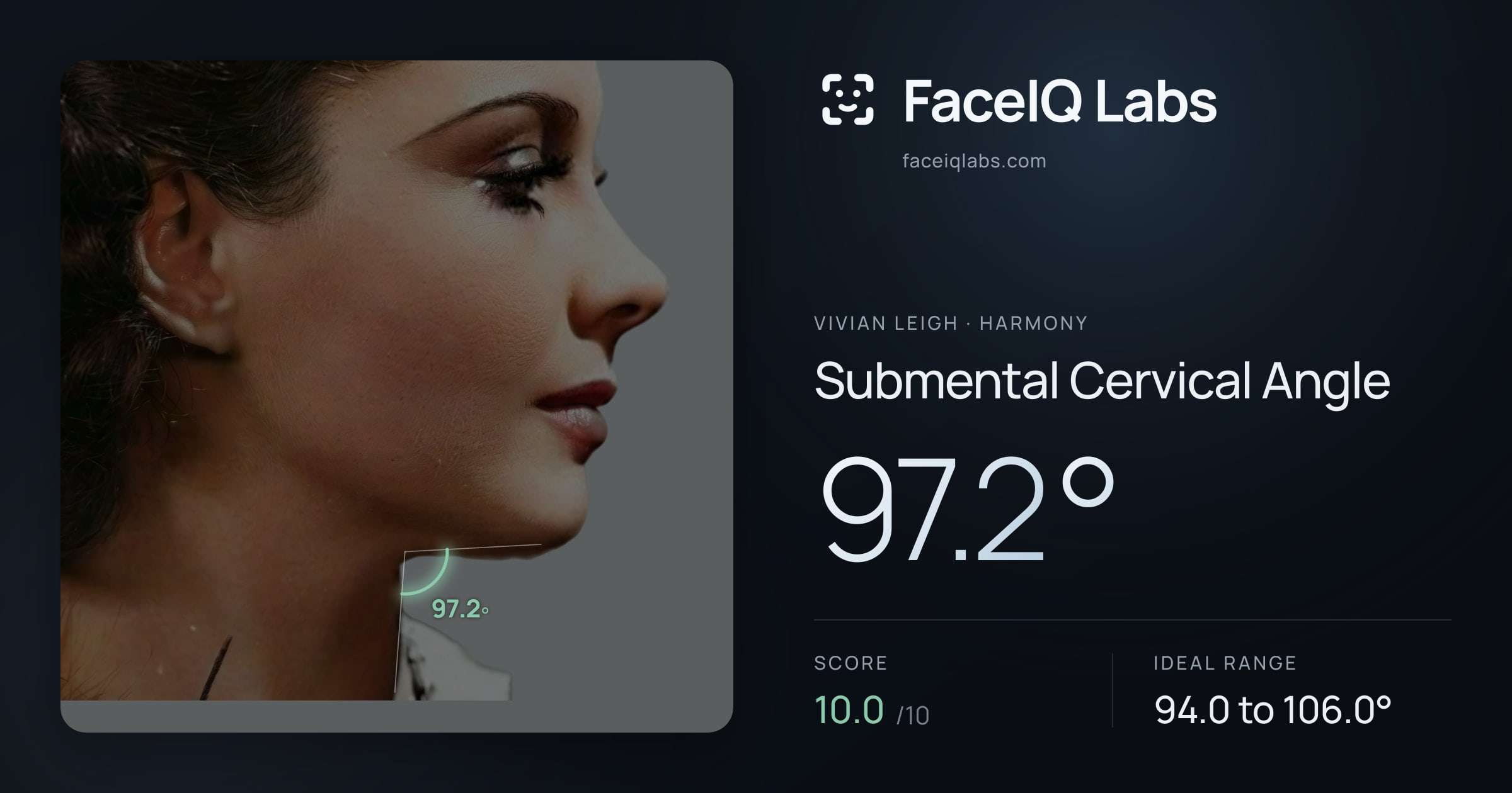 Vivian Leigh Submental Cervical Angle: 97.2°, drawn on the photo