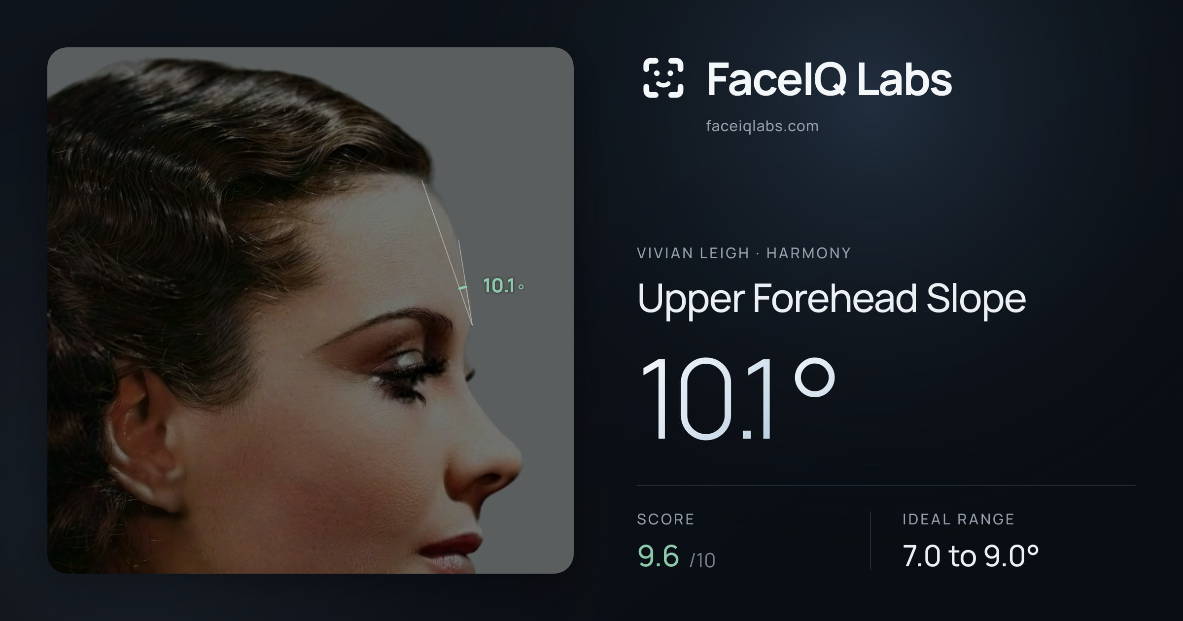 Vivian Leigh Upper Forehead Slope: 10.1°, drawn on the photo