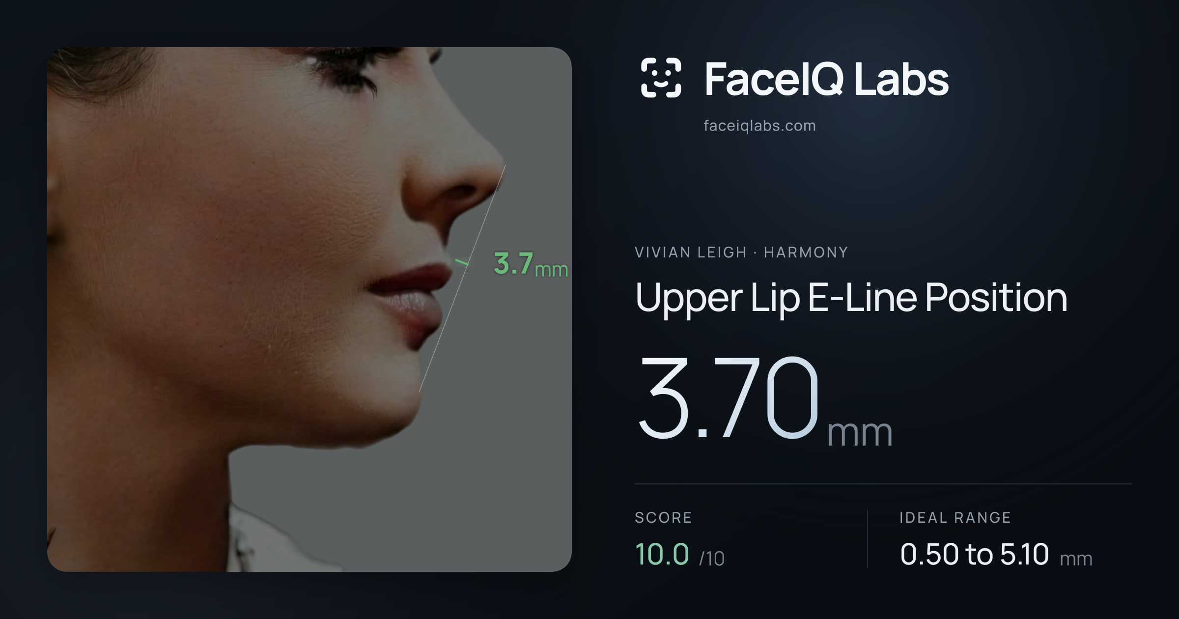 Vivian Leigh Upper Lip E-Line Position: 3.70mm, drawn on the photo