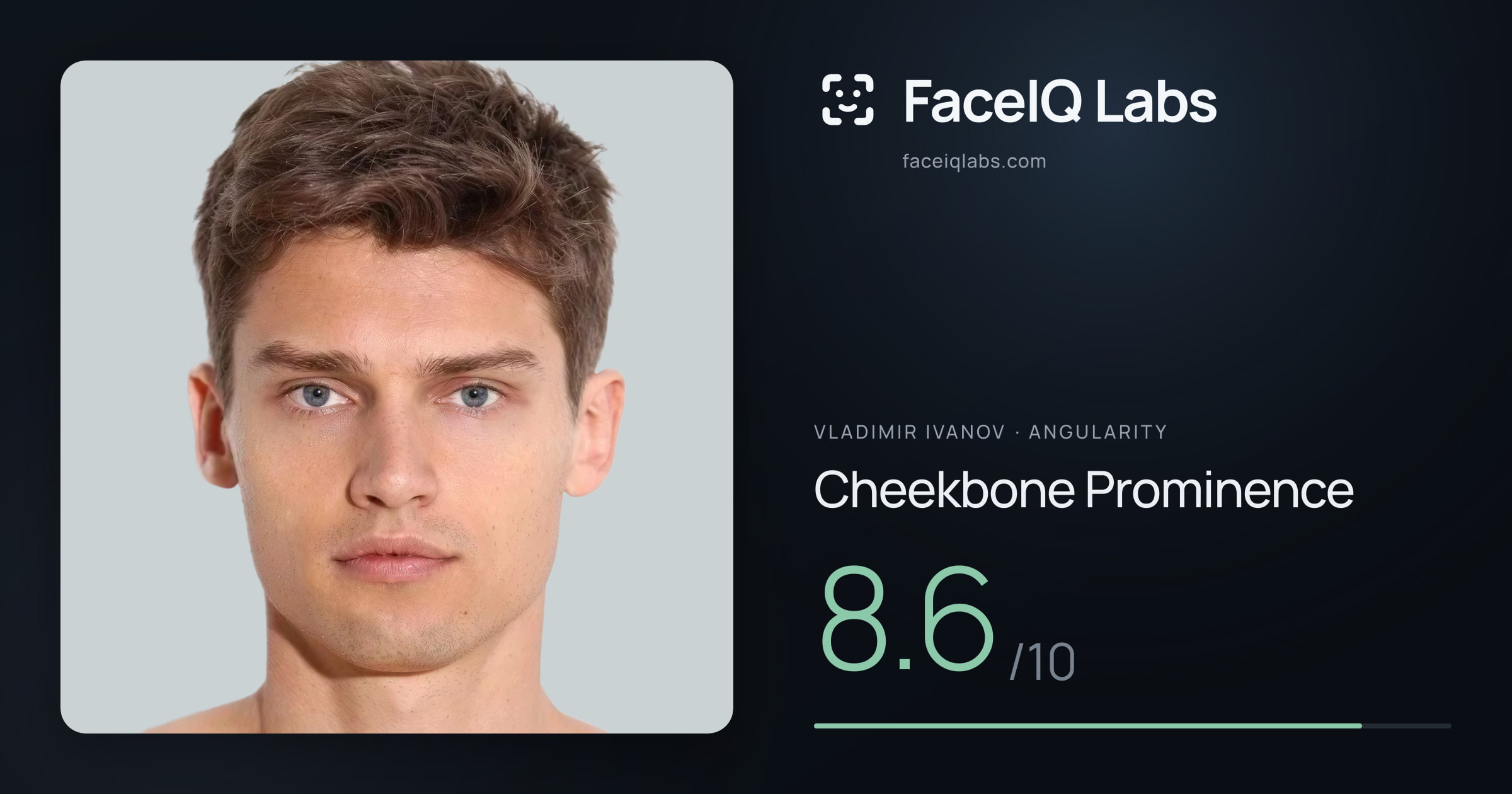 Vladimir Ivanov Cheekbone Prominence: 8.6/10, drawn on the photo