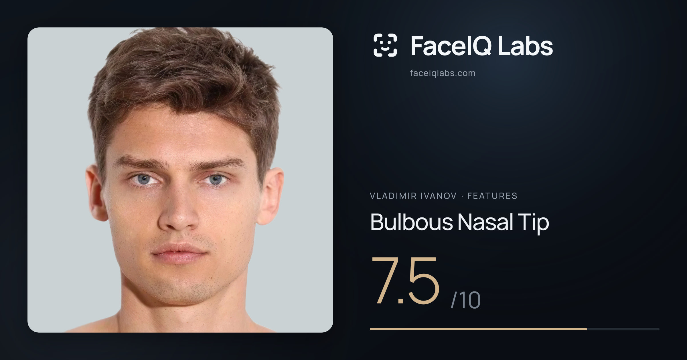 Vladimir Ivanov Bulbous Nasal Tip: 7.5/10, drawn on the photo