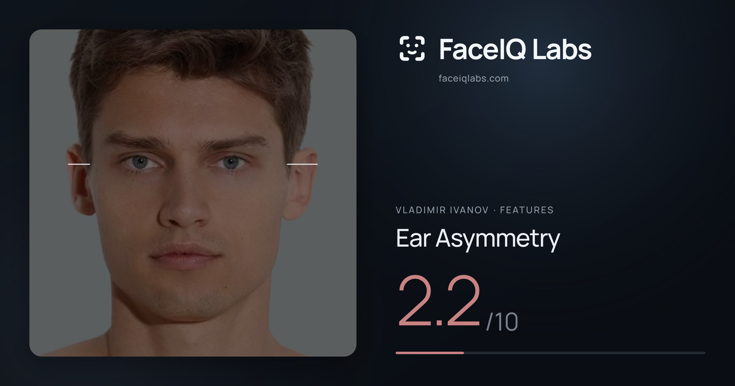 Vladimir Ivanov Ear Asymmetry: 2.2/10, drawn on the photo