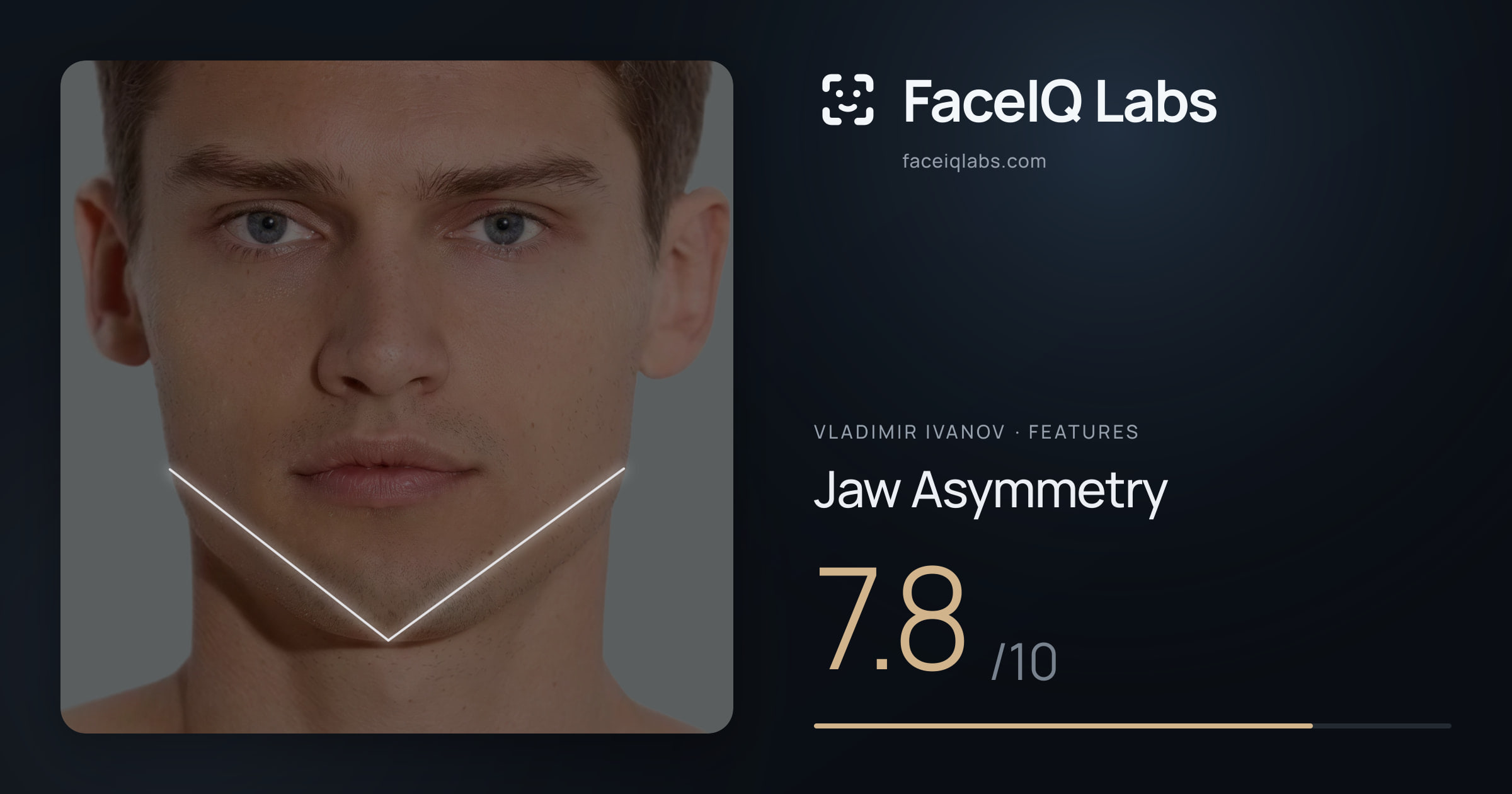 Vladimir Ivanov Jaw Asymmetry: 7.8/10, drawn on the photo