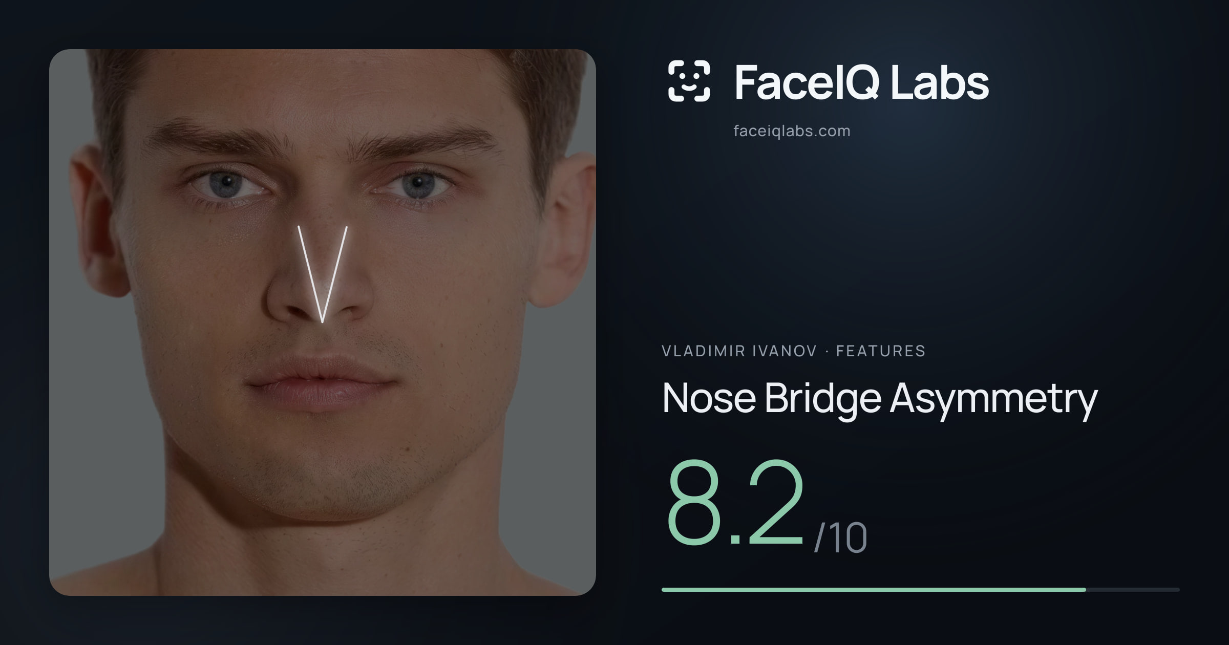 Vladimir Ivanov Nose Bridge Asymmetry: 8.2/10, drawn on the photo