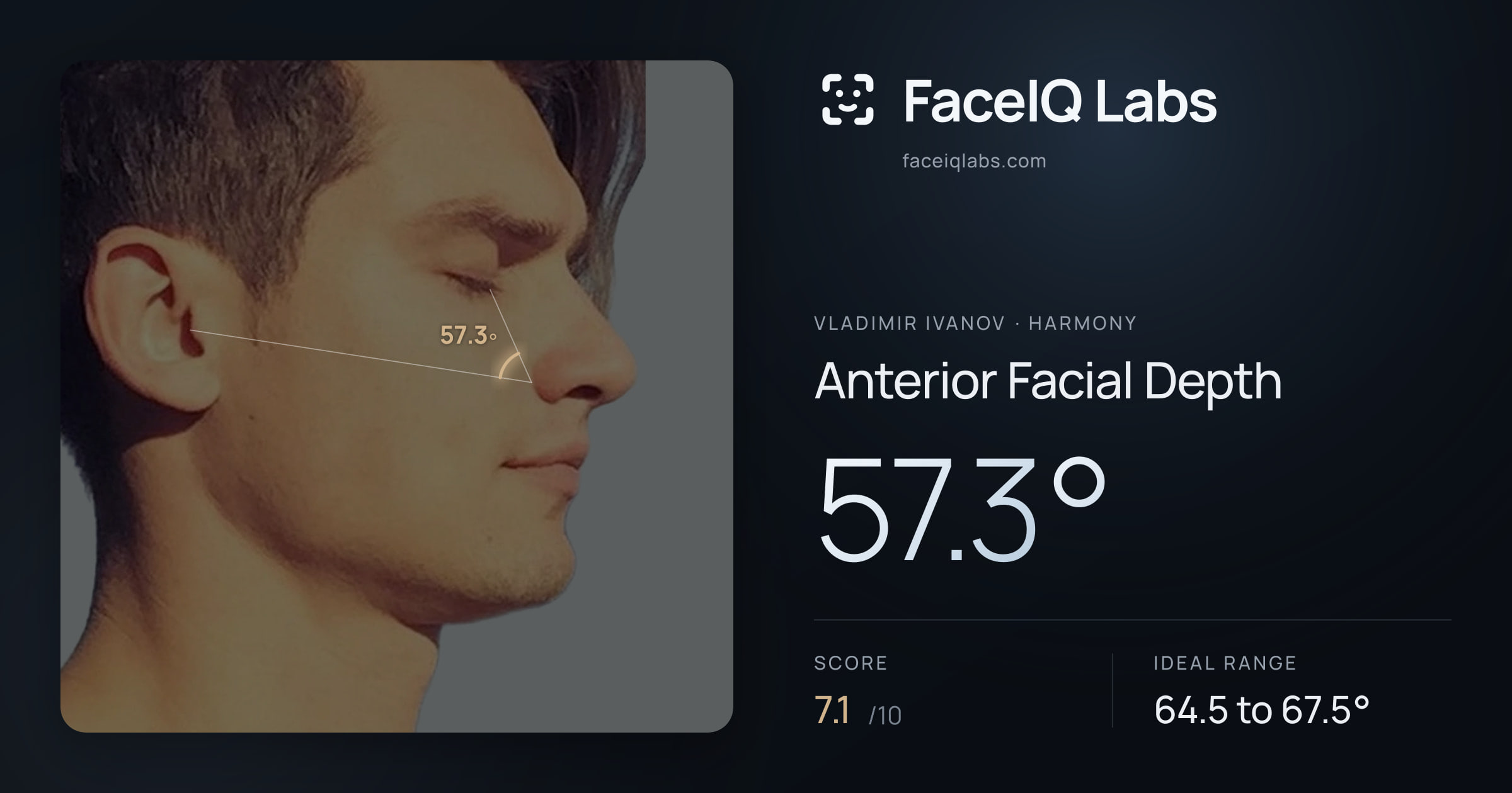Vladimir Ivanov Anterior Facial Depth: 57.3°, drawn on the photo