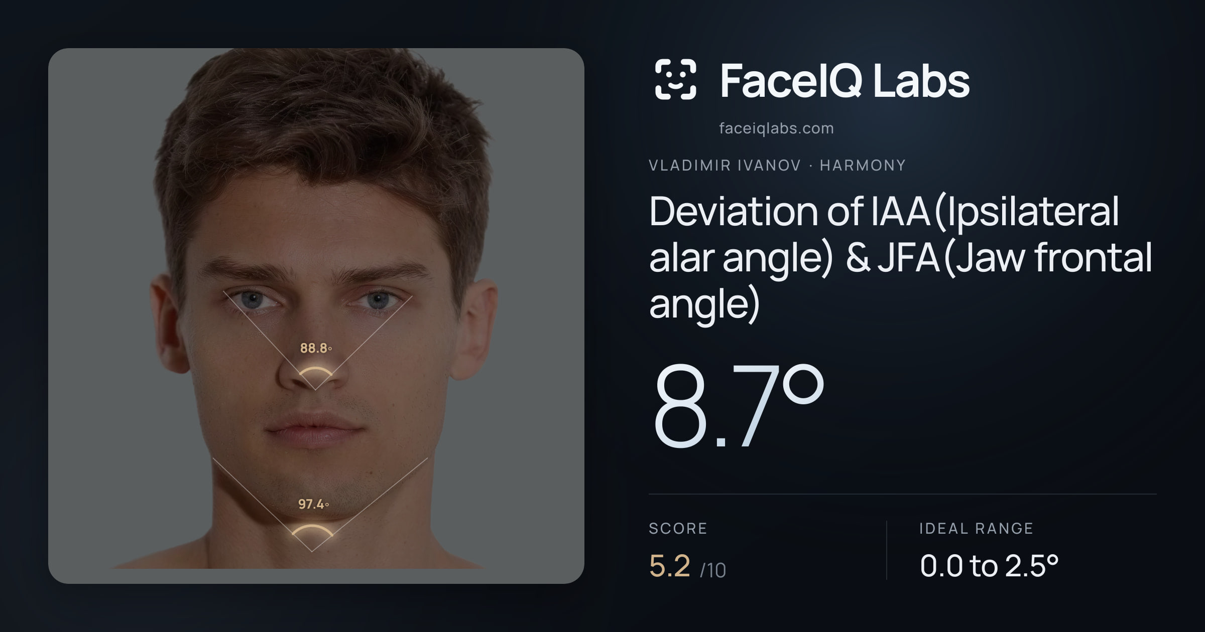 Vladimir Ivanov Deviation of IAA(Ipsilateral alar angle) & JFA(Jaw frontal angle): 8.7°, drawn on the photo