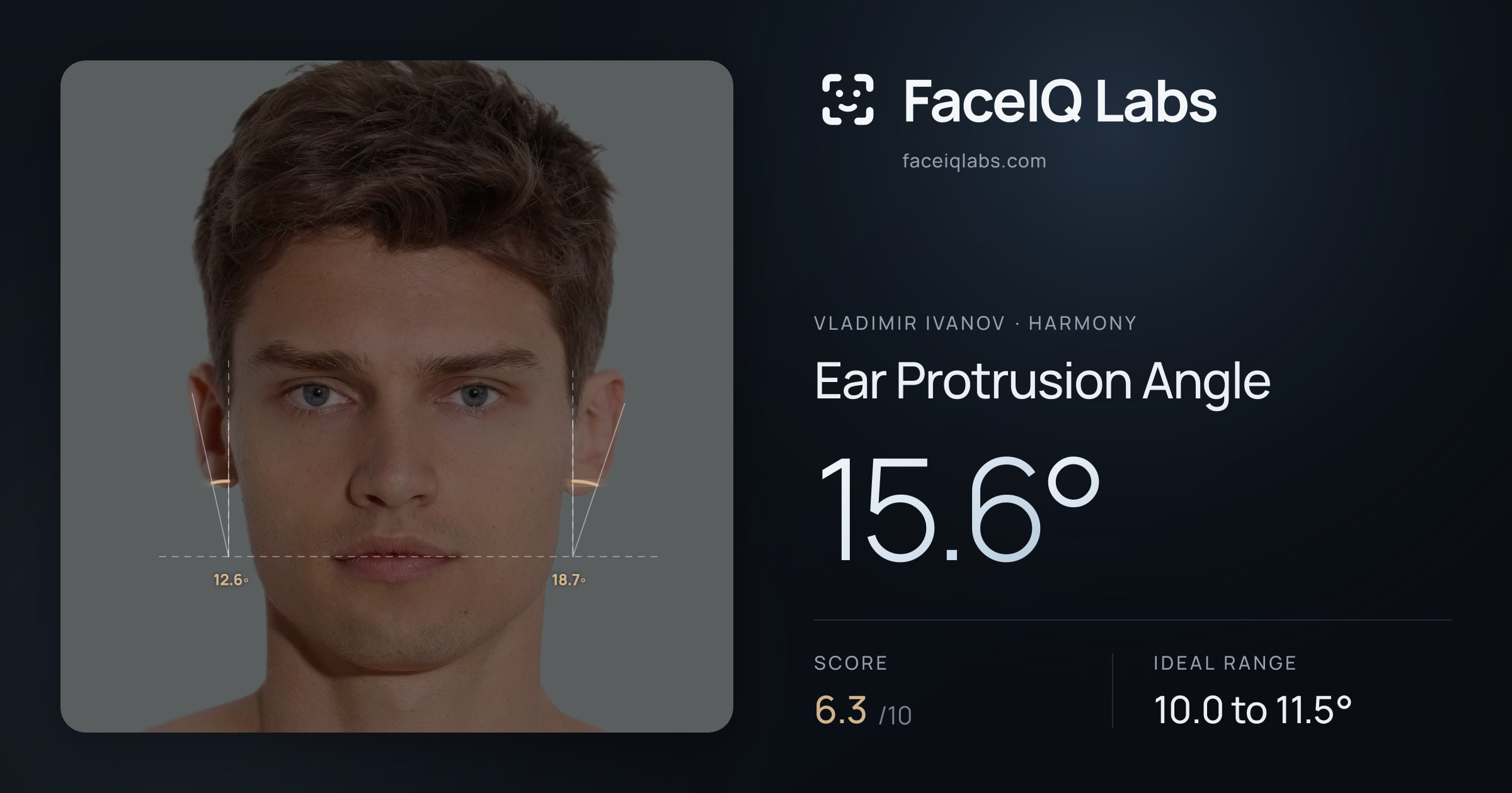 Vladimir Ivanov Ear Protrusion Angle: 15.6°, drawn on the photo