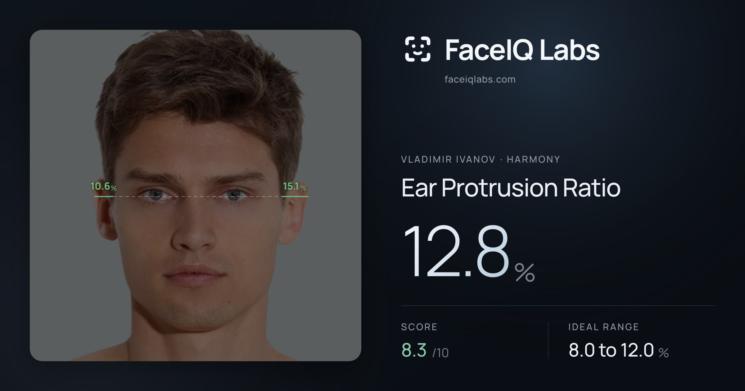 Vladimir Ivanov Ear Protrusion Ratio: 12.8%, drawn on the photo