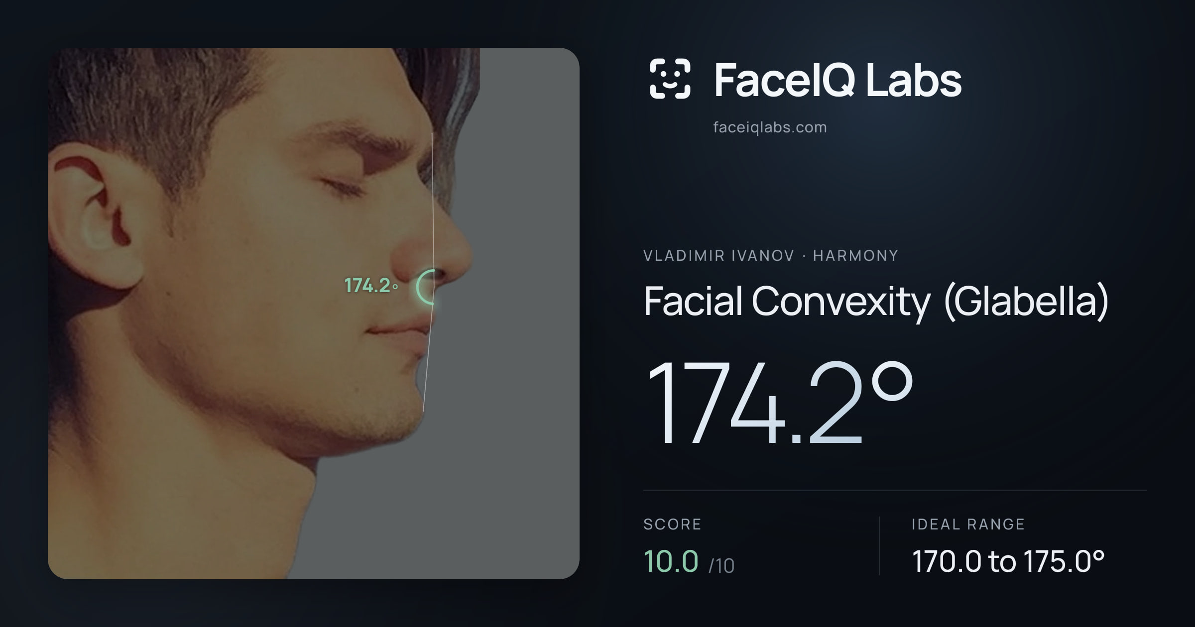 Vladimir Ivanov Facial Convexity (Glabella): 174.2°, drawn on the photo