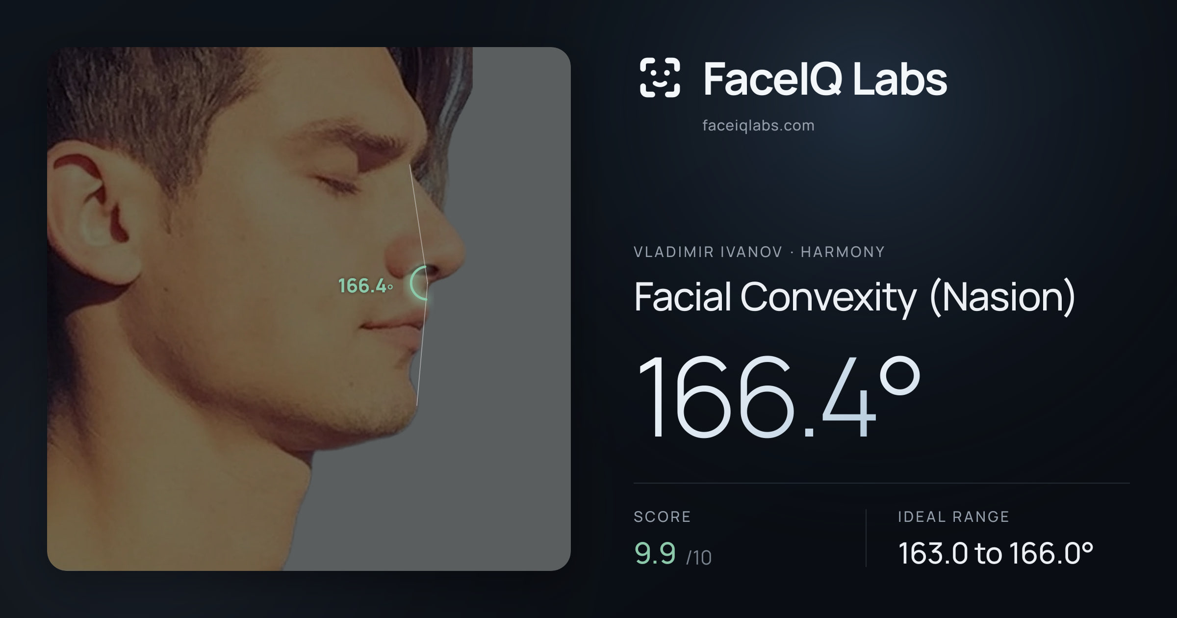 Vladimir Ivanov Facial Convexity (Nasion): 166.4°, drawn on the photo