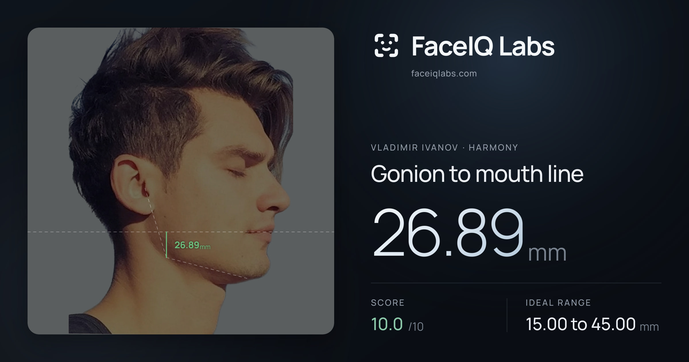 Vladimir Ivanov Gonion to mouth line: 26.89mm, drawn on the photo