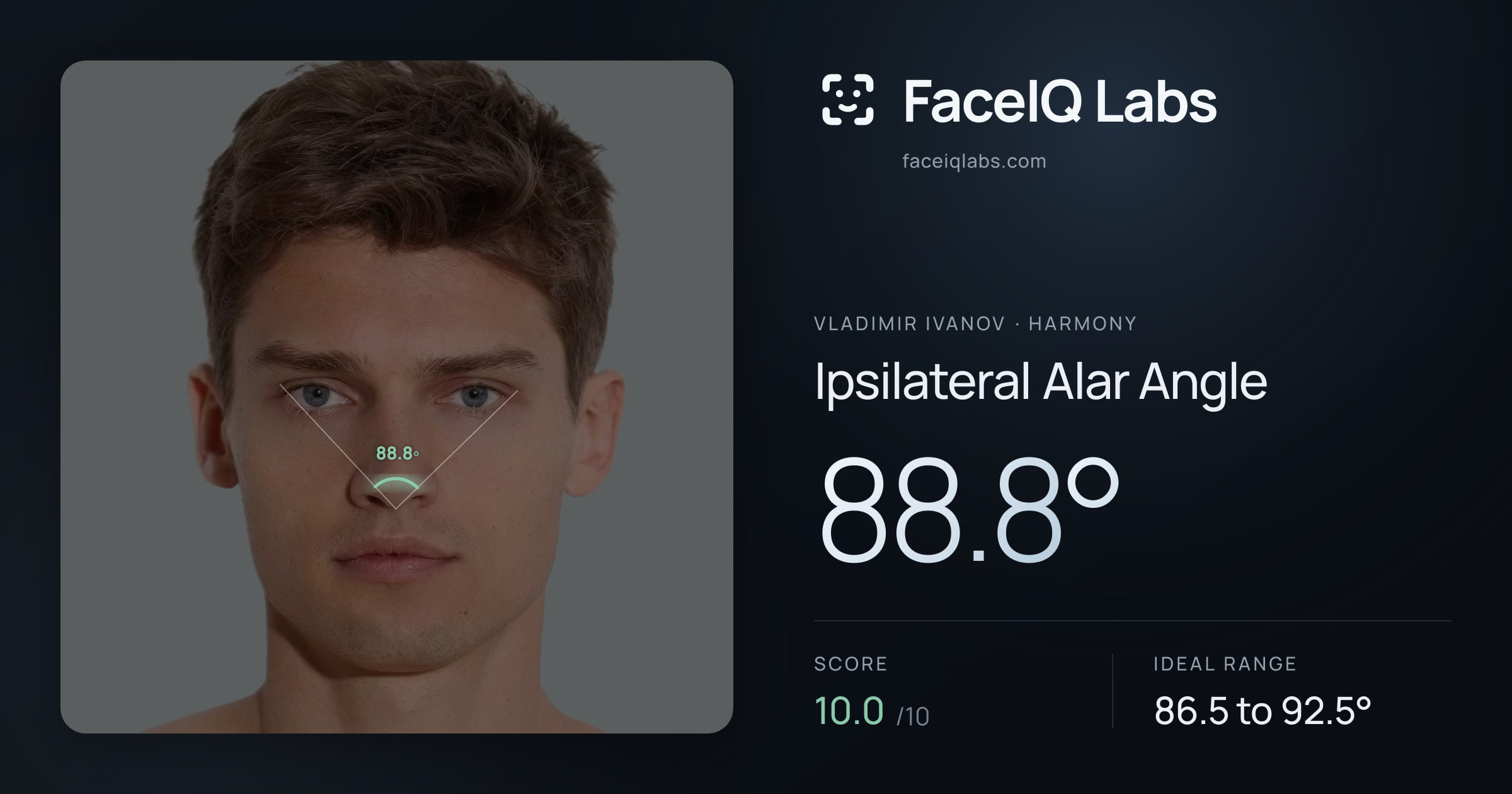 Vladimir Ivanov Ipsilateral Alar Angle: 88.8°, drawn on the photo