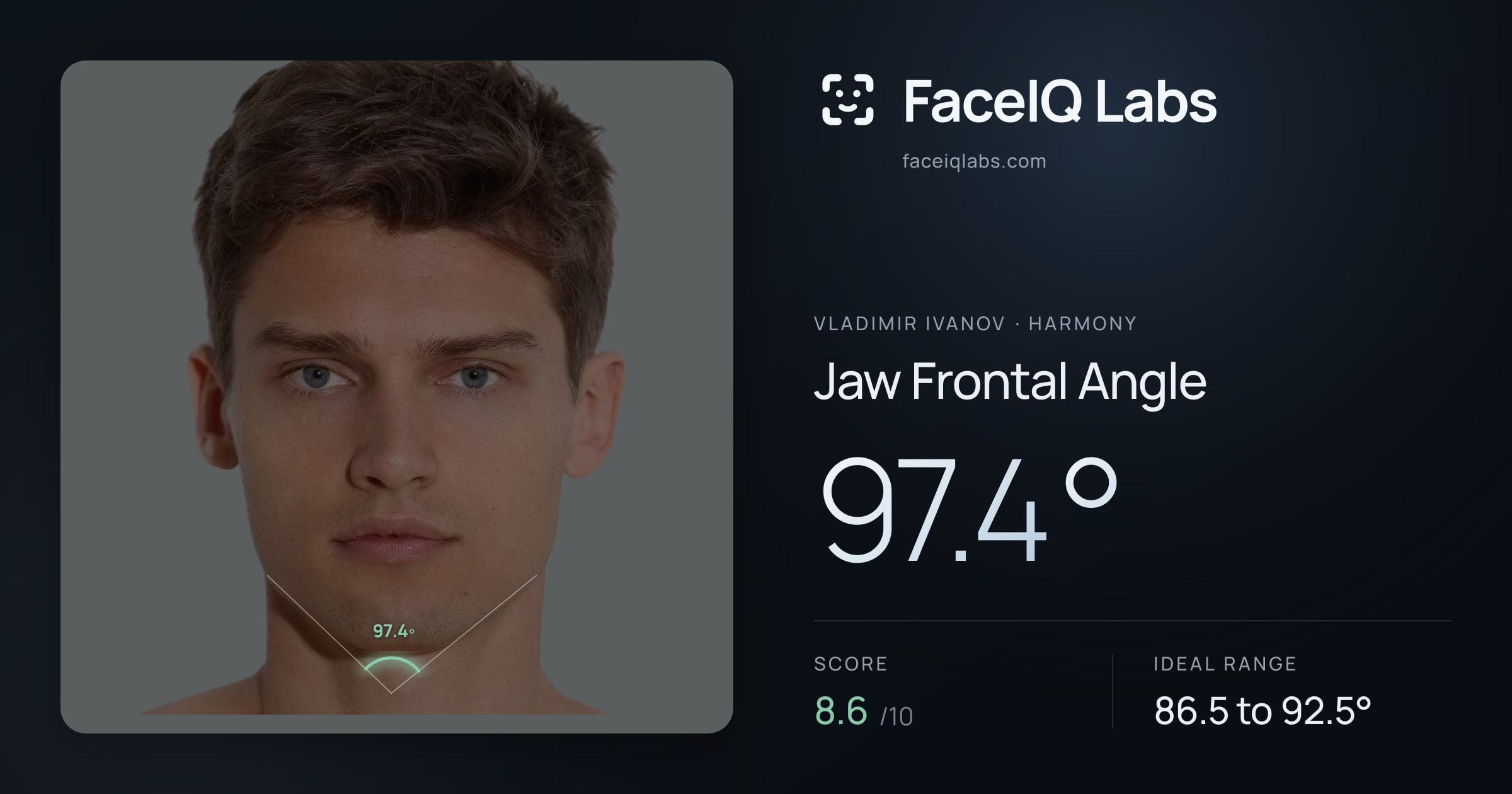 Vladimir Ivanov Jaw Frontal Angle: 97.4°, drawn on the photo