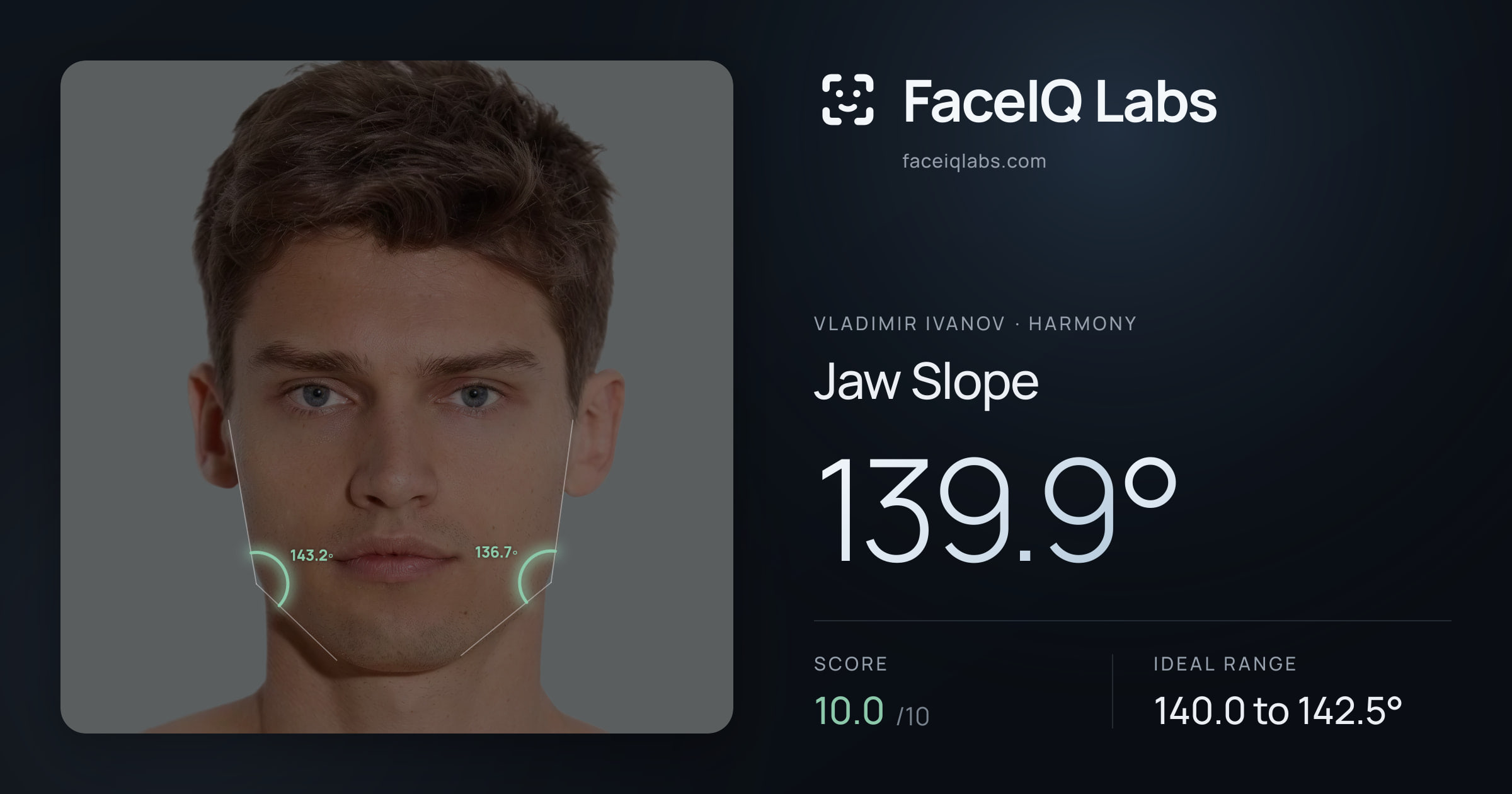Vladimir Ivanov Jaw Slope: 139.9°, drawn on the photo