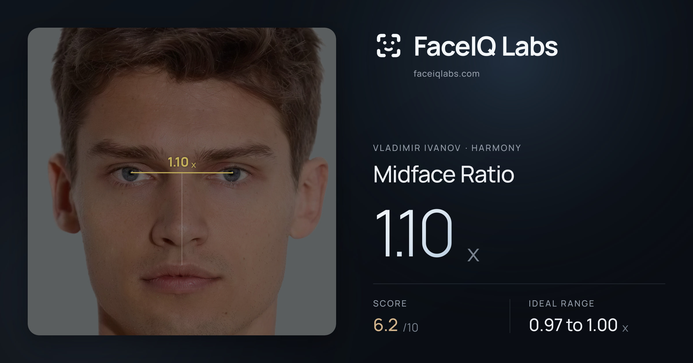 Vladimir Ivanov Midface Ratio: 1.10x, drawn on the photo