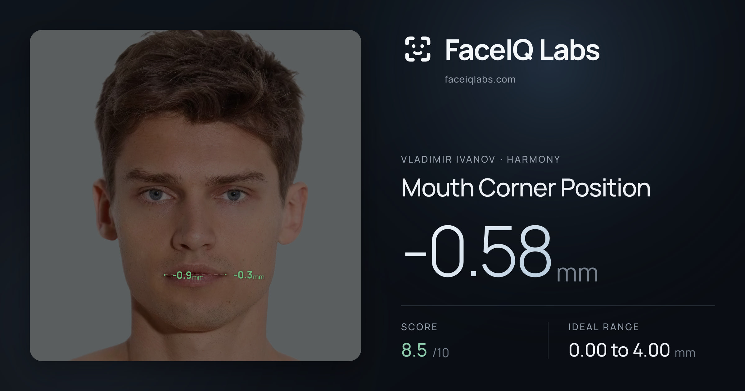 Vladimir Ivanov Mouth Corner Position: -0.58mm, drawn on the photo