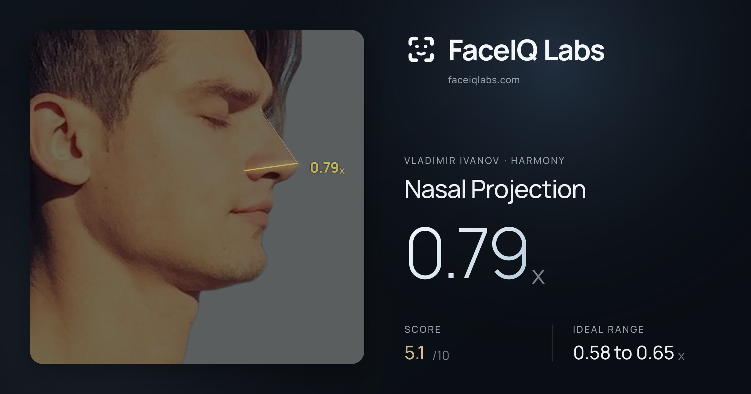 Vladimir Ivanov Nasal Projection: 0.79x, drawn on the photo
