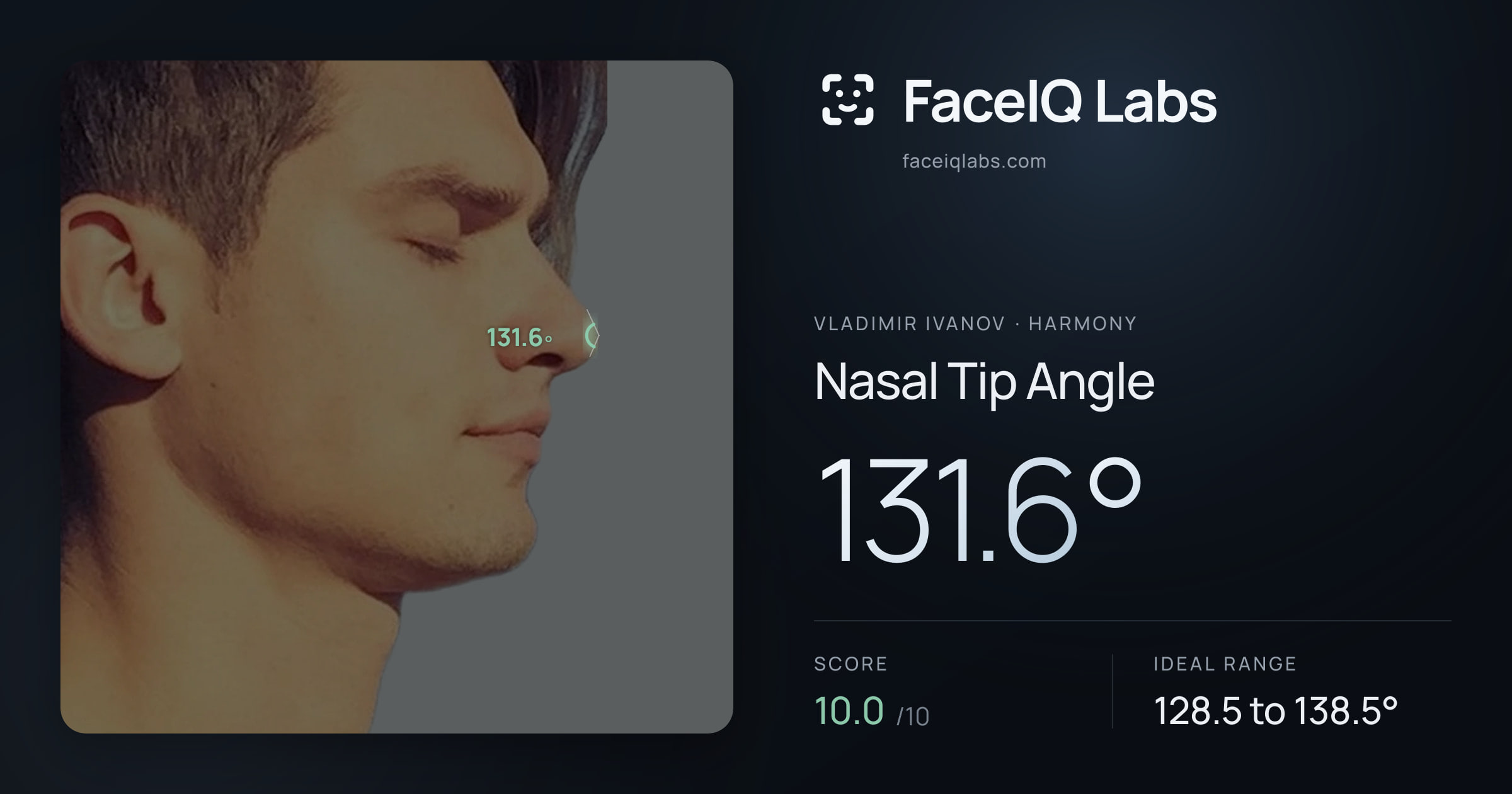 Vladimir Ivanov Nasal Tip Angle: 131.6°, drawn on the photo