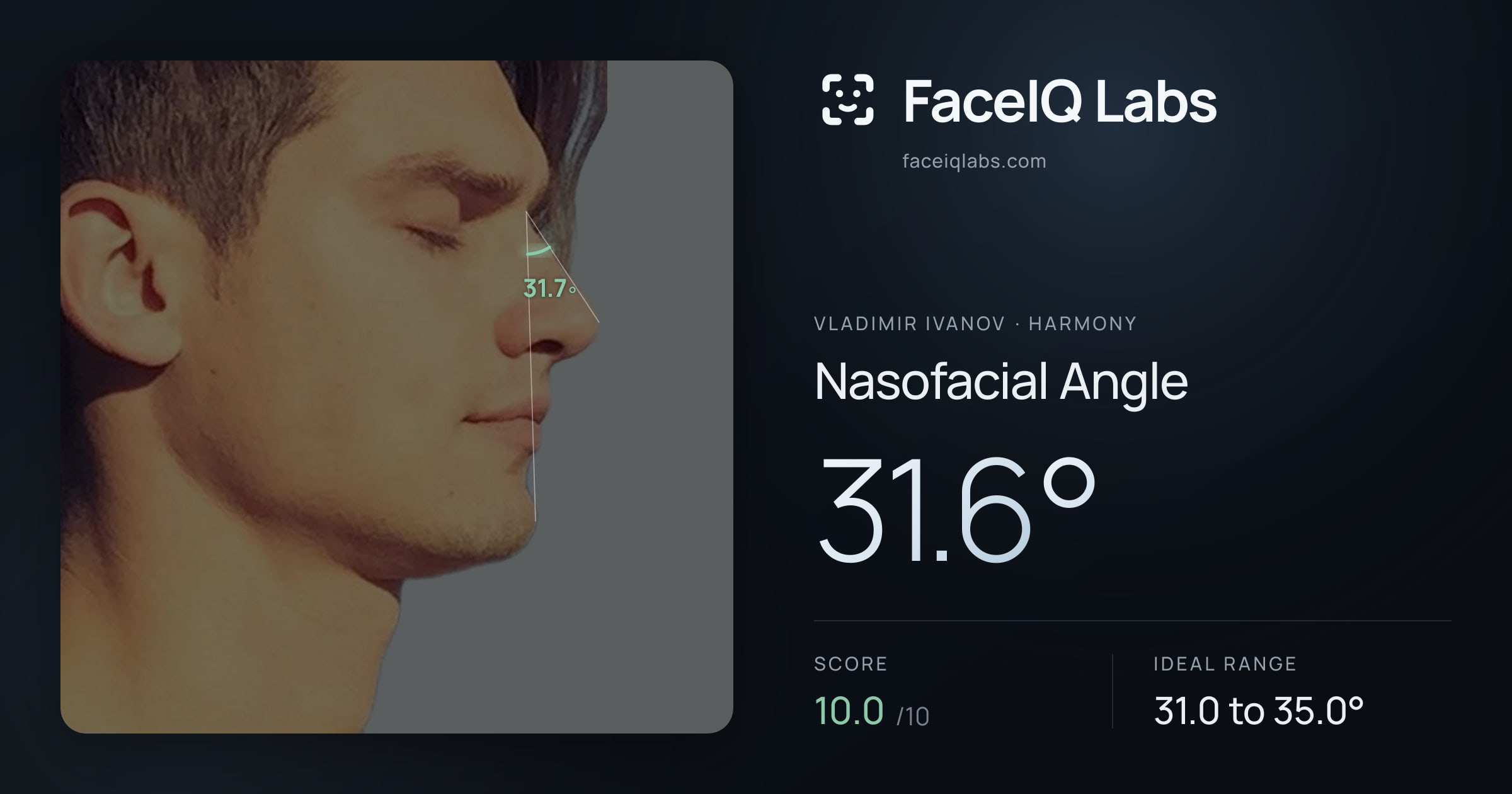 Vladimir Ivanov Nasofacial Angle: 31.6°, drawn on the photo