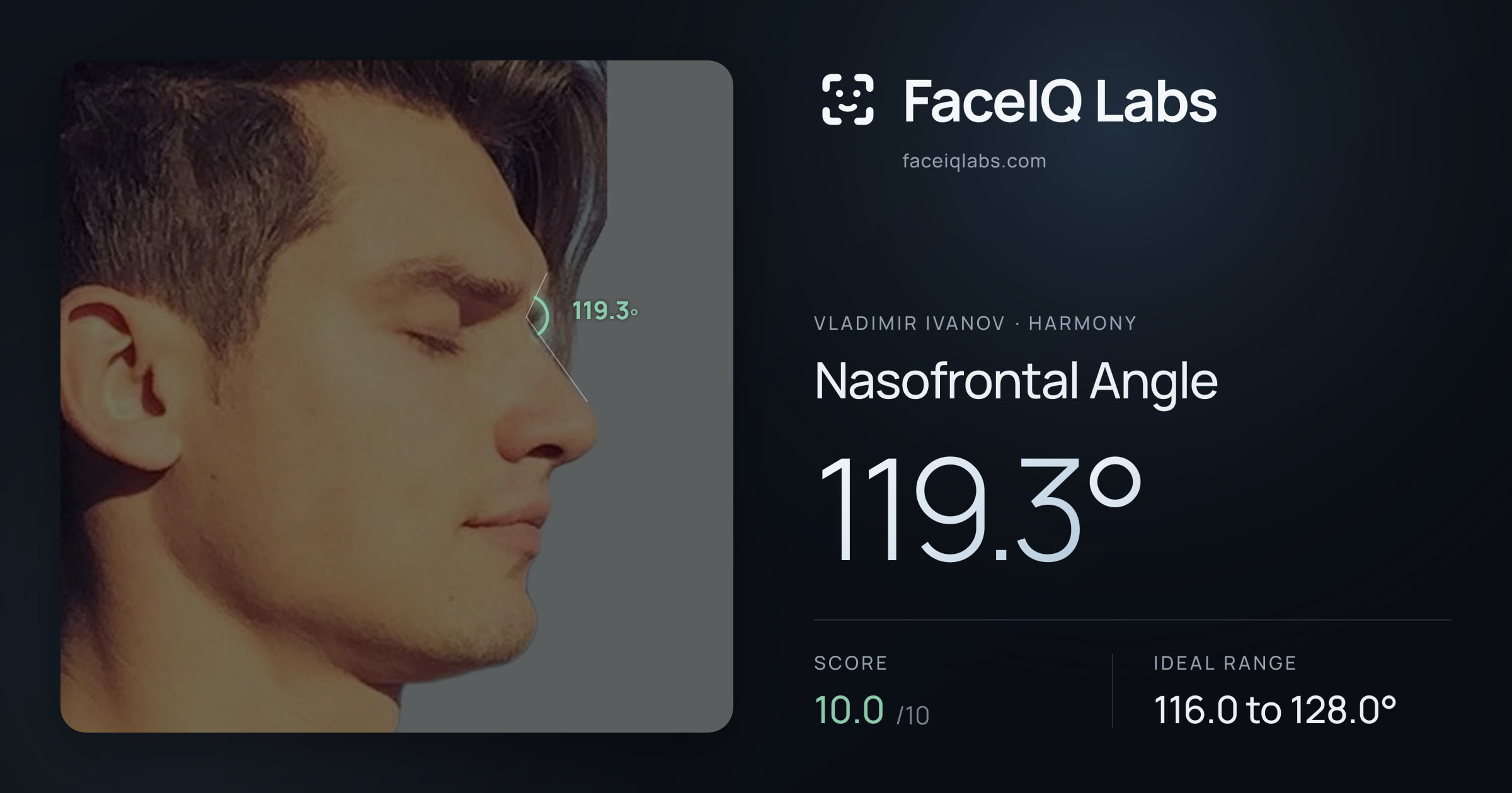 Vladimir Ivanov Nasofrontal Angle: 119.3°, drawn on the photo