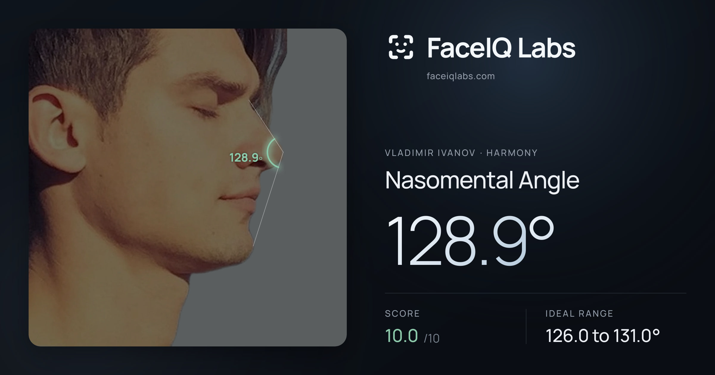 Vladimir Ivanov Nasomental Angle: 128.9°, drawn on the photo