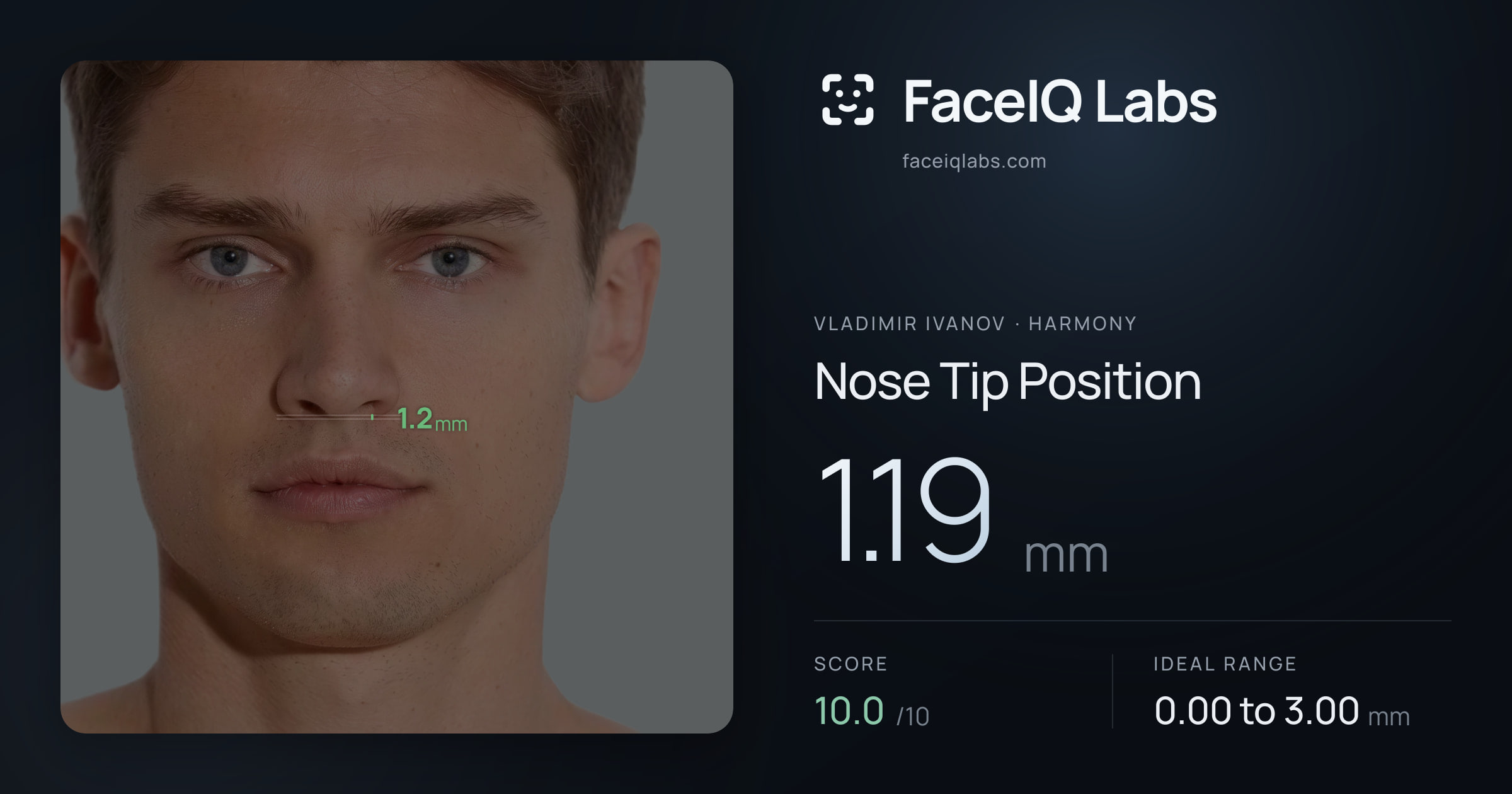 Vladimir Ivanov Nose Tip Position: 1.19mm, drawn on the photo