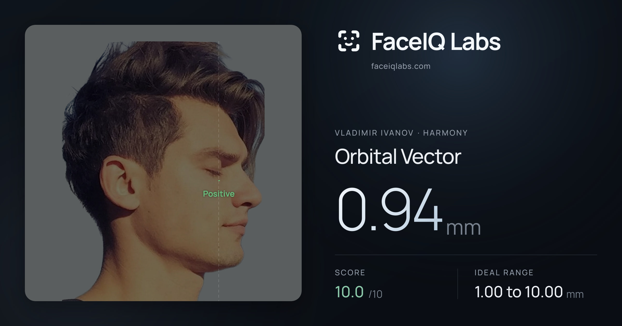 Vladimir Ivanov Orbital Vector: 0.94mm, drawn on the photo