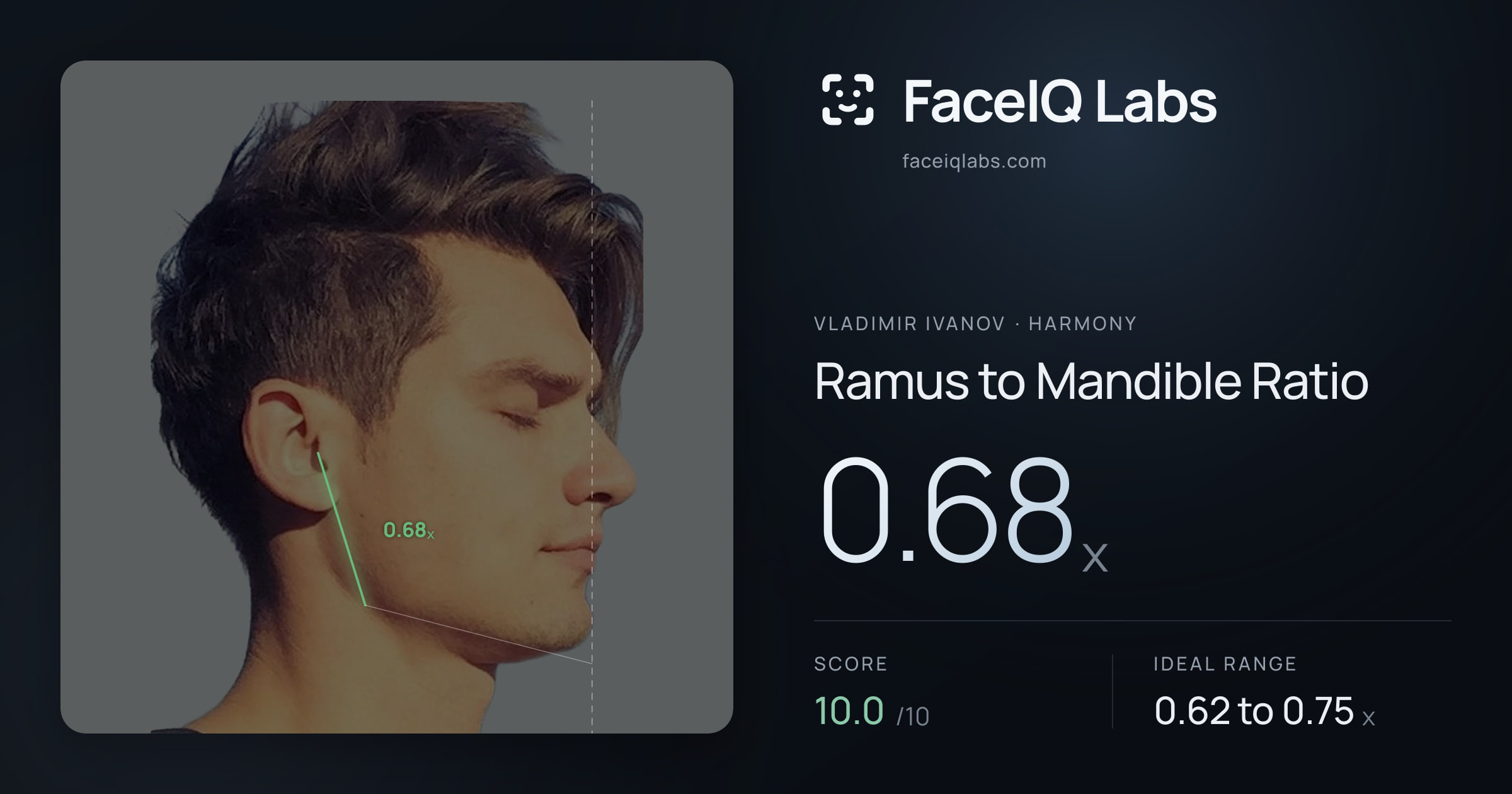 Vladimir Ivanov Ramus to Mandible Ratio: 0.68x, drawn on the photo