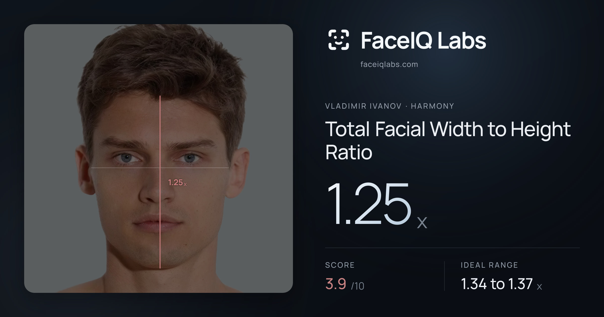Vladimir Ivanov Total Facial Width to Height Ratio: 1.25x, drawn on the photo
