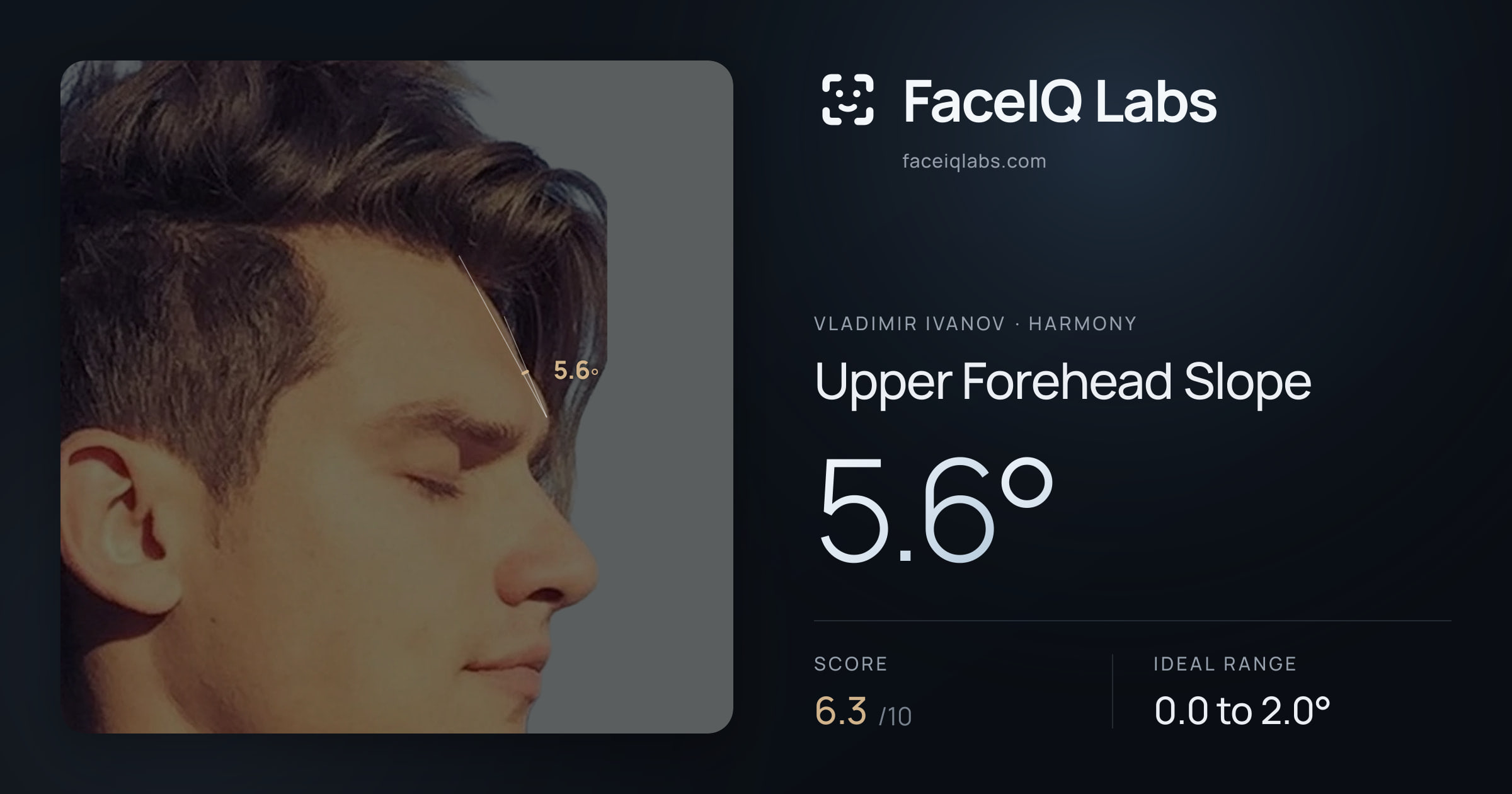 Vladimir Ivanov Upper Forehead Slope: 5.6°, drawn on the photo