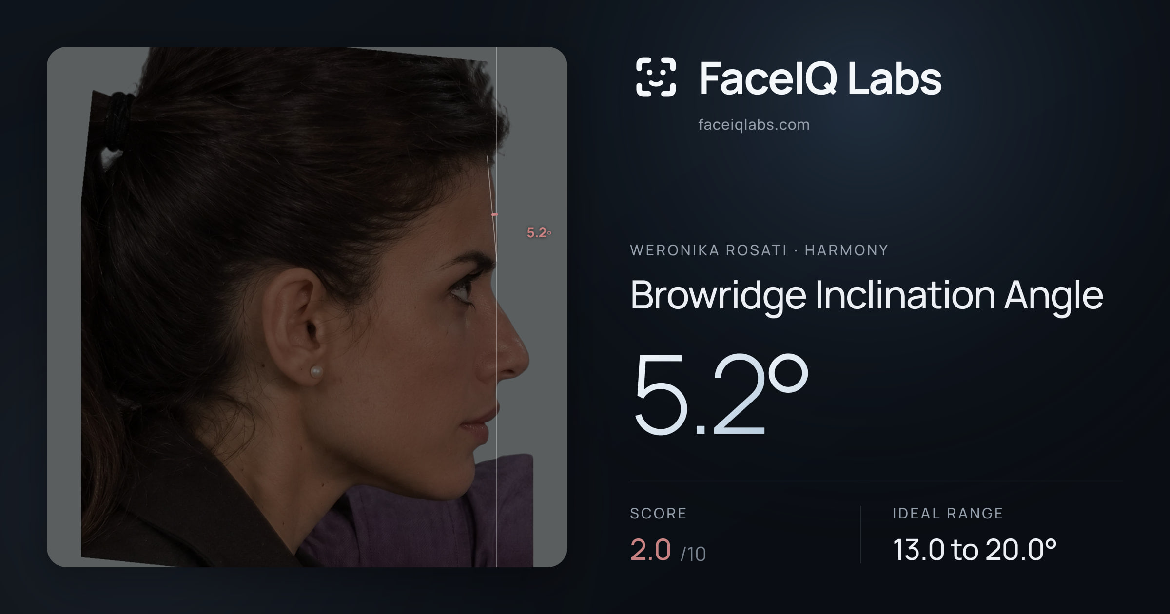 Weronika Rosati Browridge Inclination Angle: 5.2°, drawn on the photo