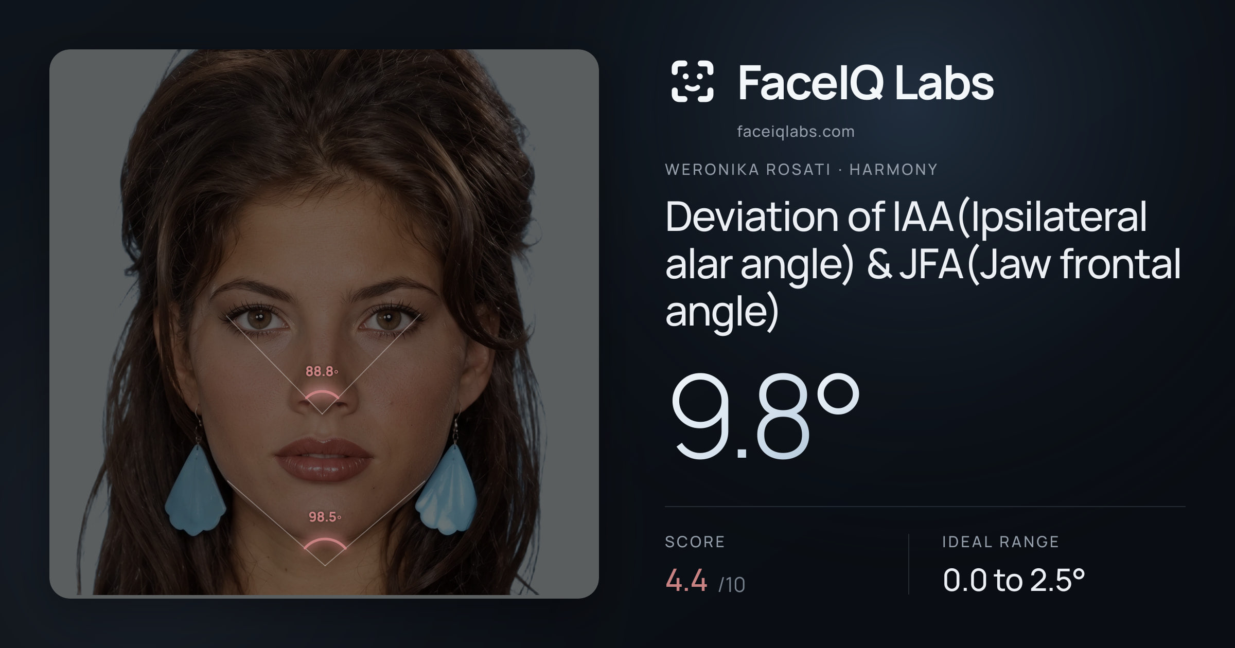 Weronika Rosati Deviation of IAA(Ipsilateral alar angle) & JFA(Jaw frontal angle): 9.8°, drawn on the photo