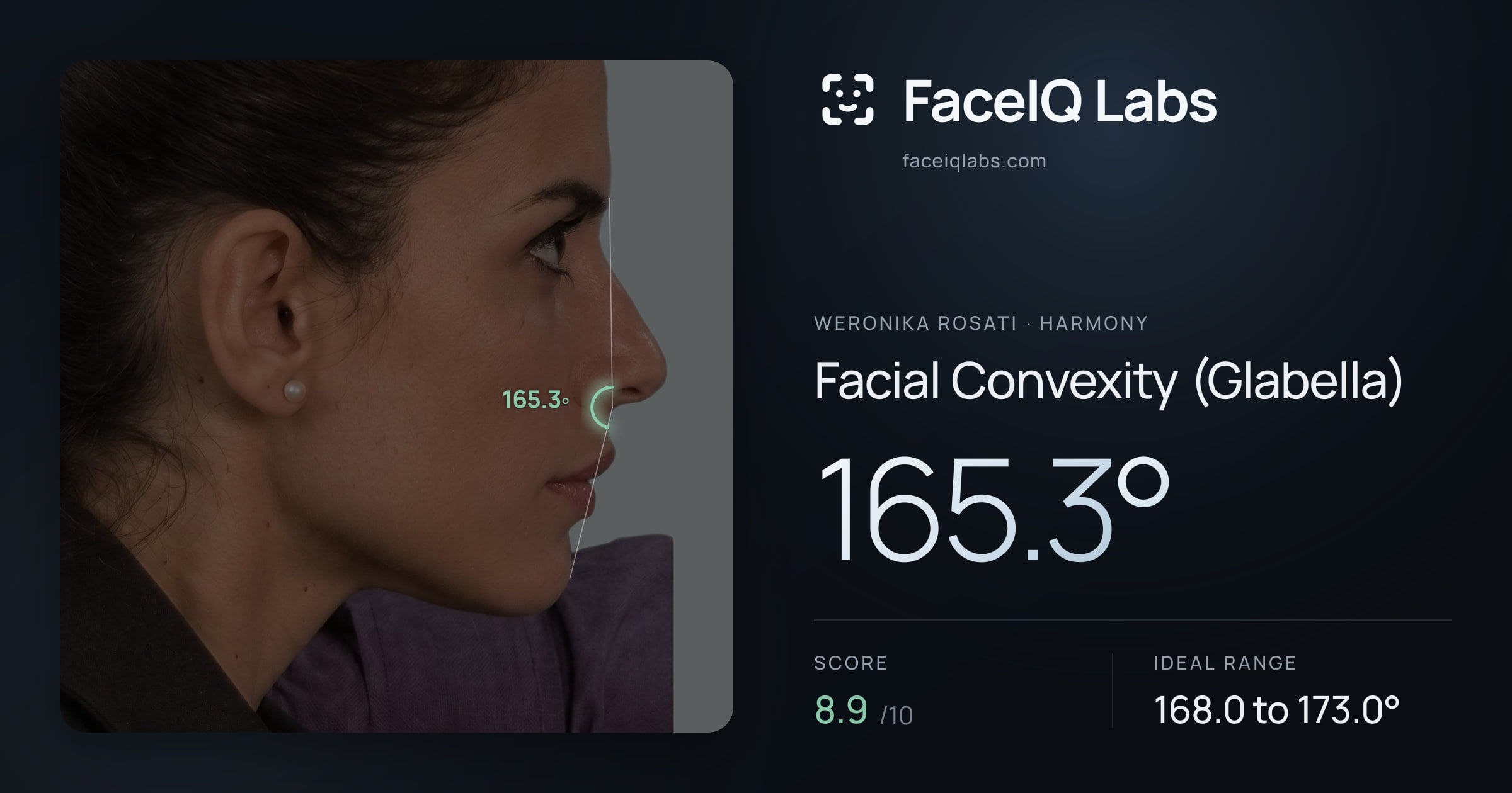 Weronika Rosati Facial Convexity (Glabella): 165.3°, drawn on the photo
