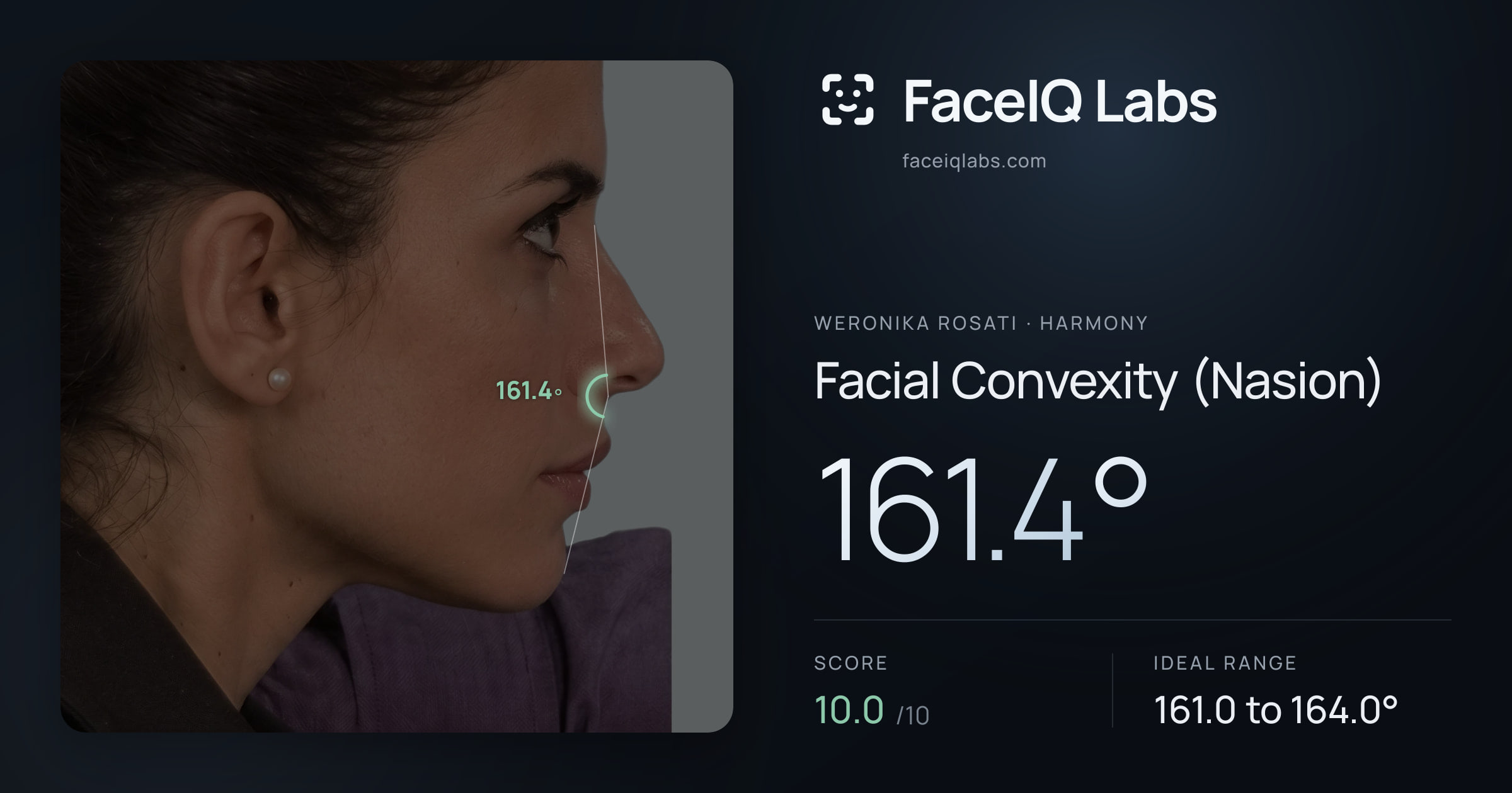 Weronika Rosati Facial Convexity (Nasion): 161.4°, drawn on the photo