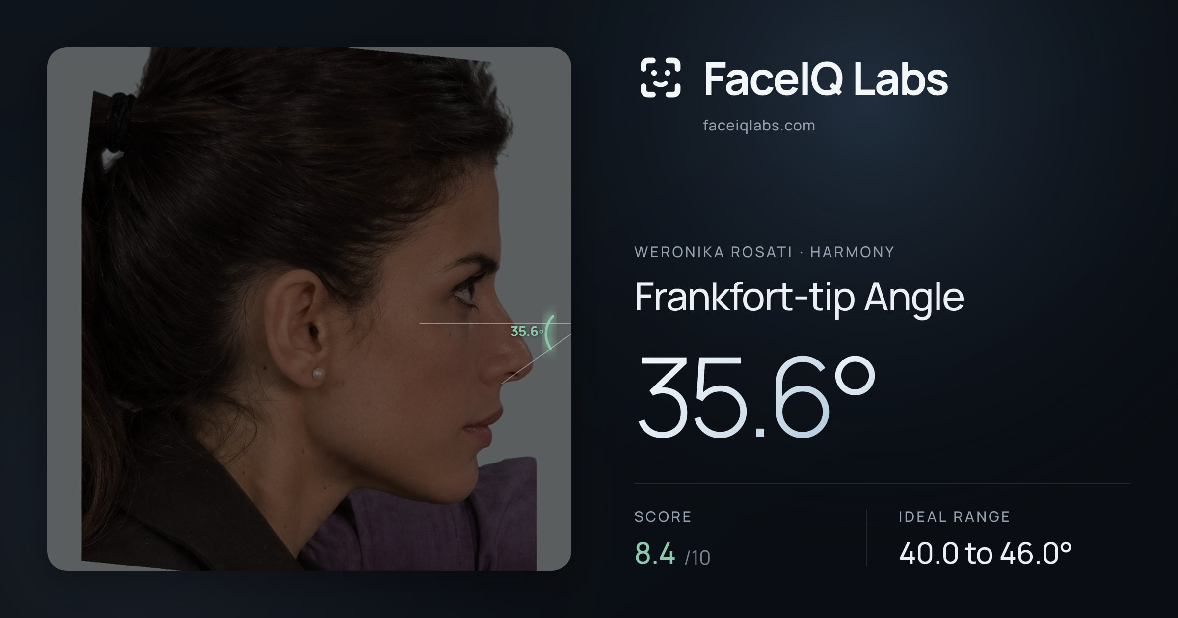 Weronika Rosati Frankfort-tip Angle: 35.6°, drawn on the photo