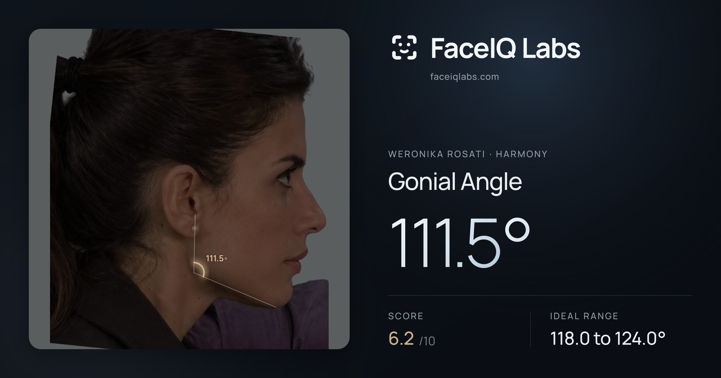 Weronika Rosati Gonial Angle: 111.5°, drawn on the photo