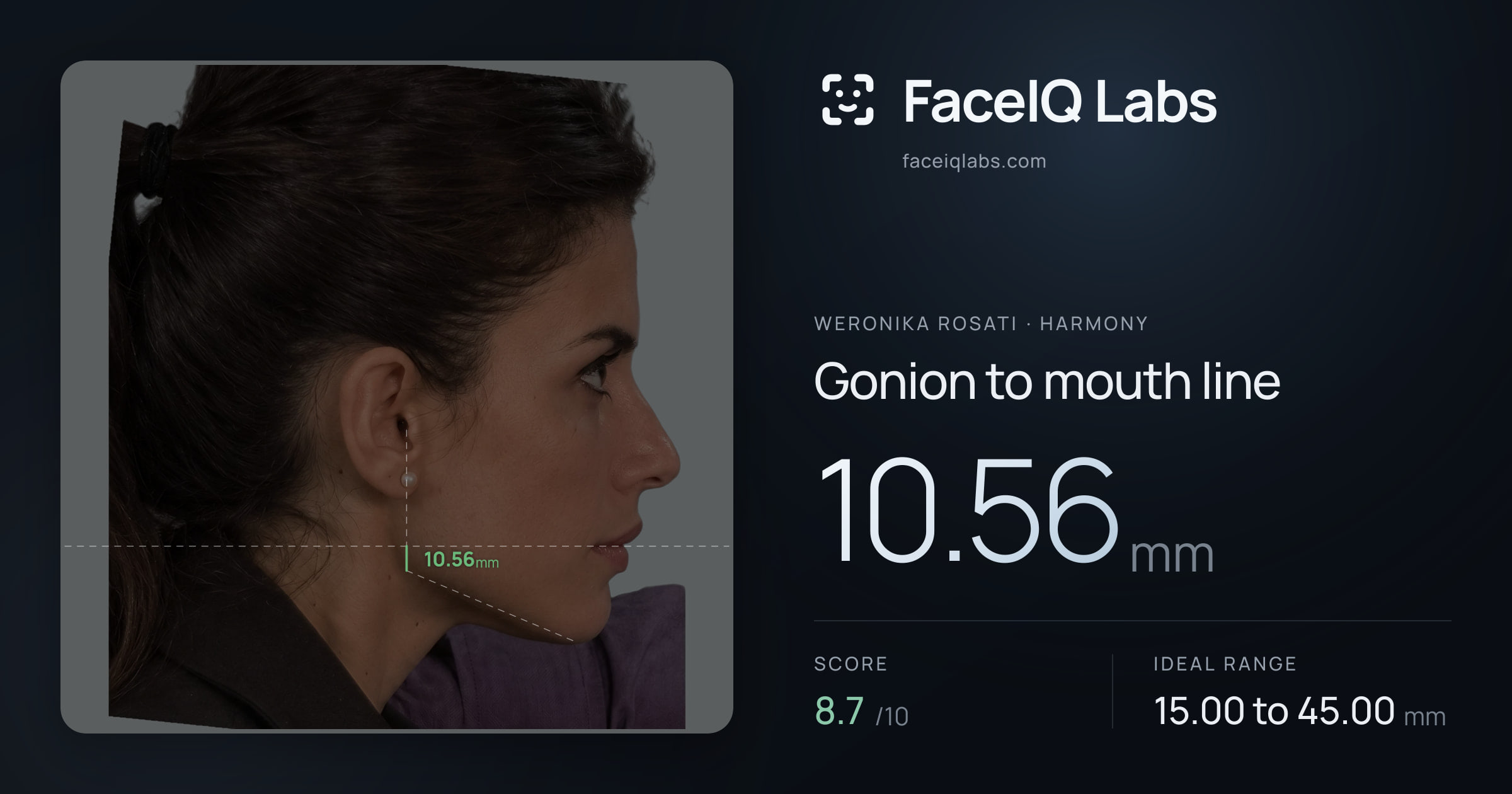Weronika Rosati Gonion to mouth line: 10.56mm, drawn on the photo