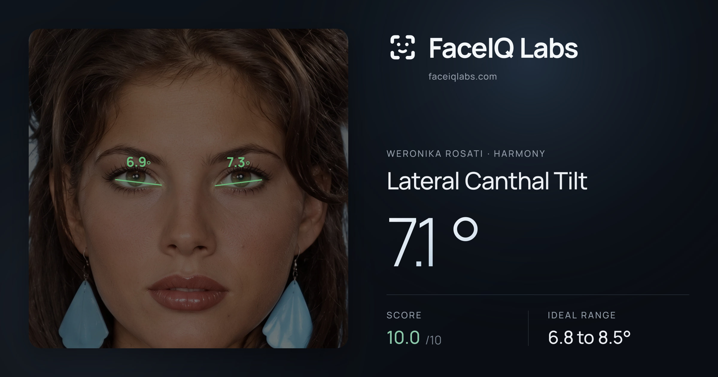 Weronika Rosati Lateral Canthal Tilt: 7.1°, drawn on the photo