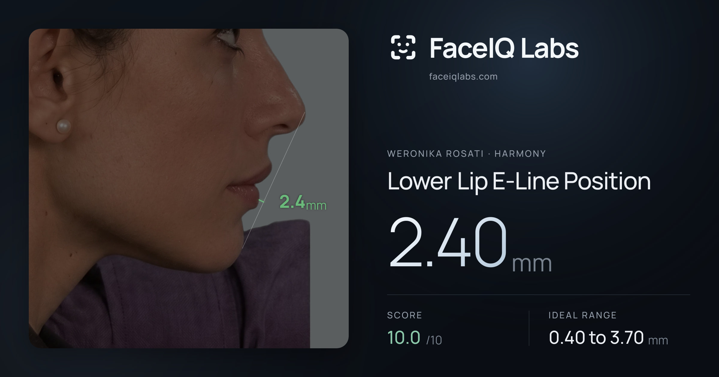 Weronika Rosati Lower Lip E-Line Position: 2.40mm, drawn on the photo