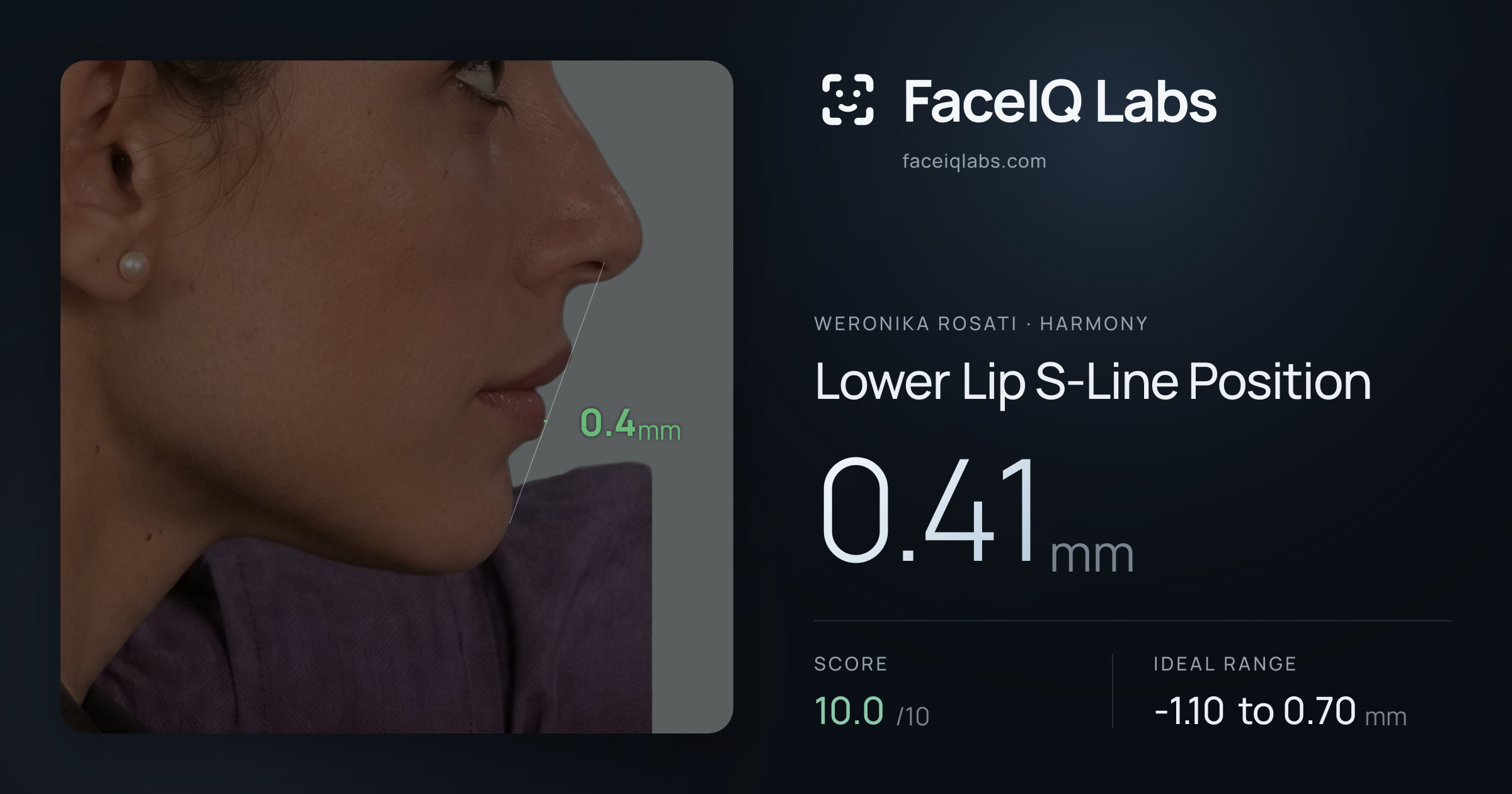 Weronika Rosati Lower Lip S-Line Position: 0.41mm, drawn on the photo